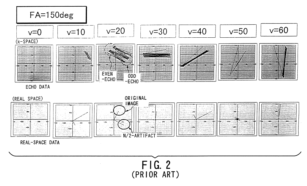 Multi-echo sequence based MR imaging for fluid in motion