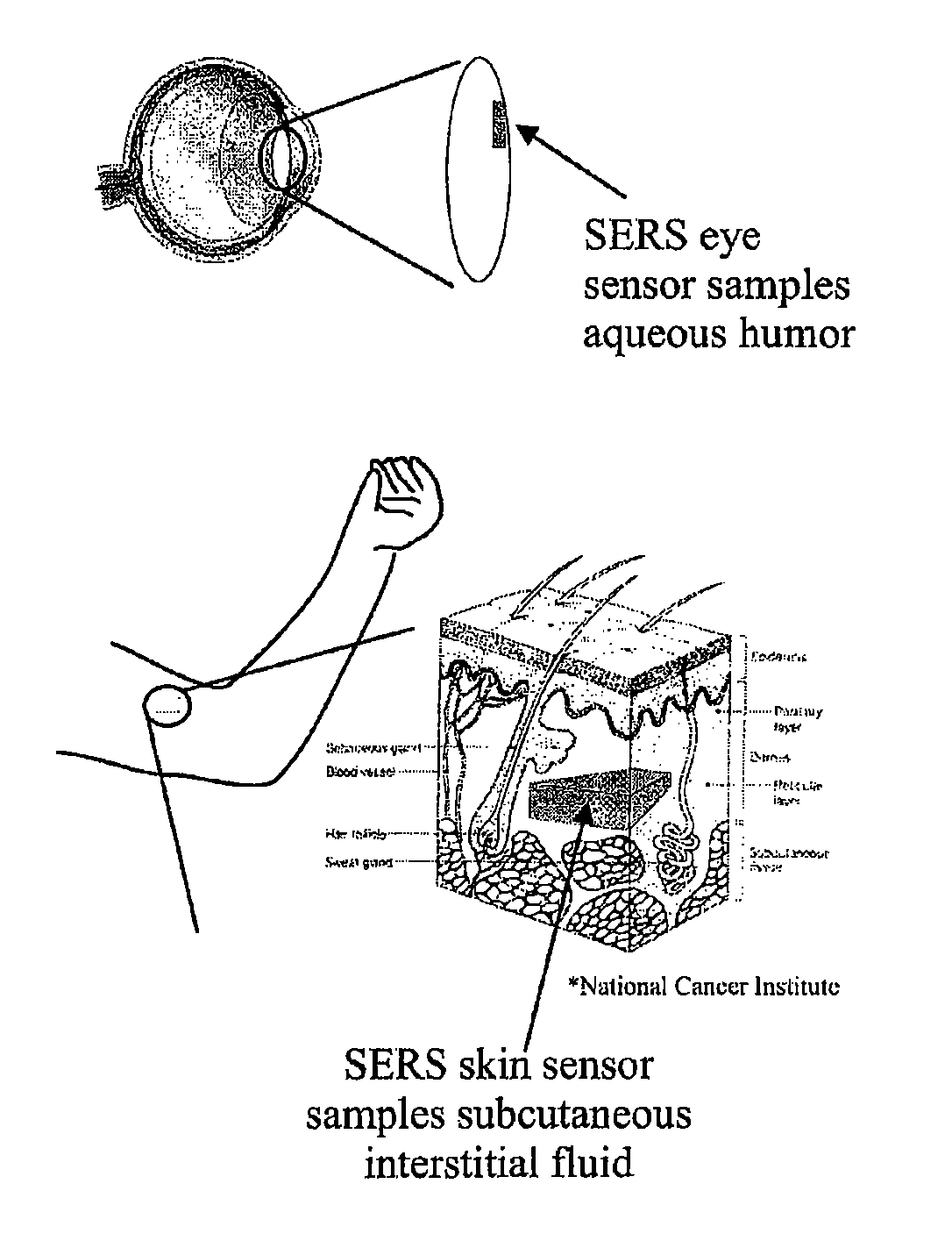 Surface-enhanced raman nanobiosensor