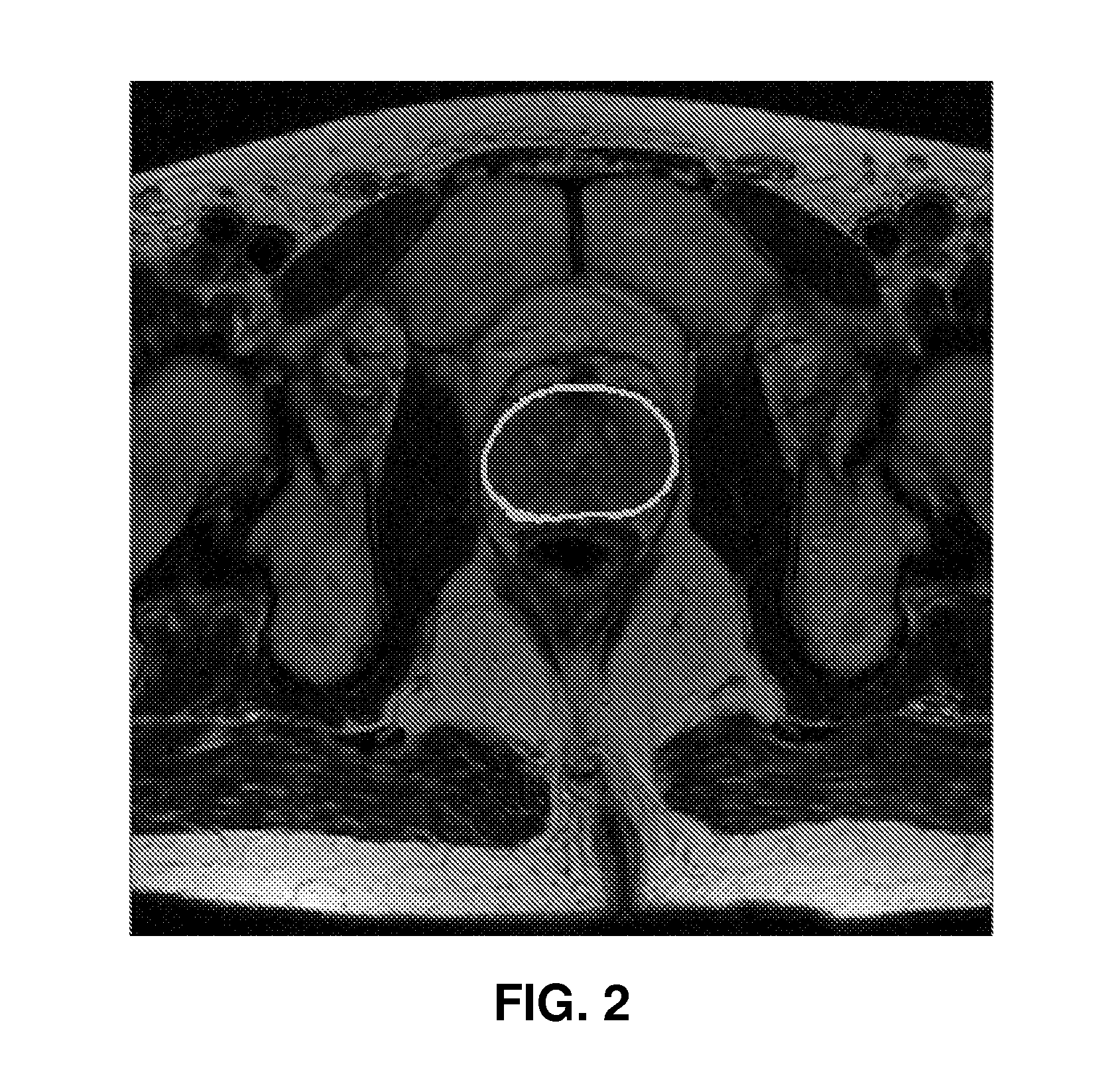 Method and Apparatus for Registering Image Data Between Different Types of Image Data to Guide a Medical Procedure