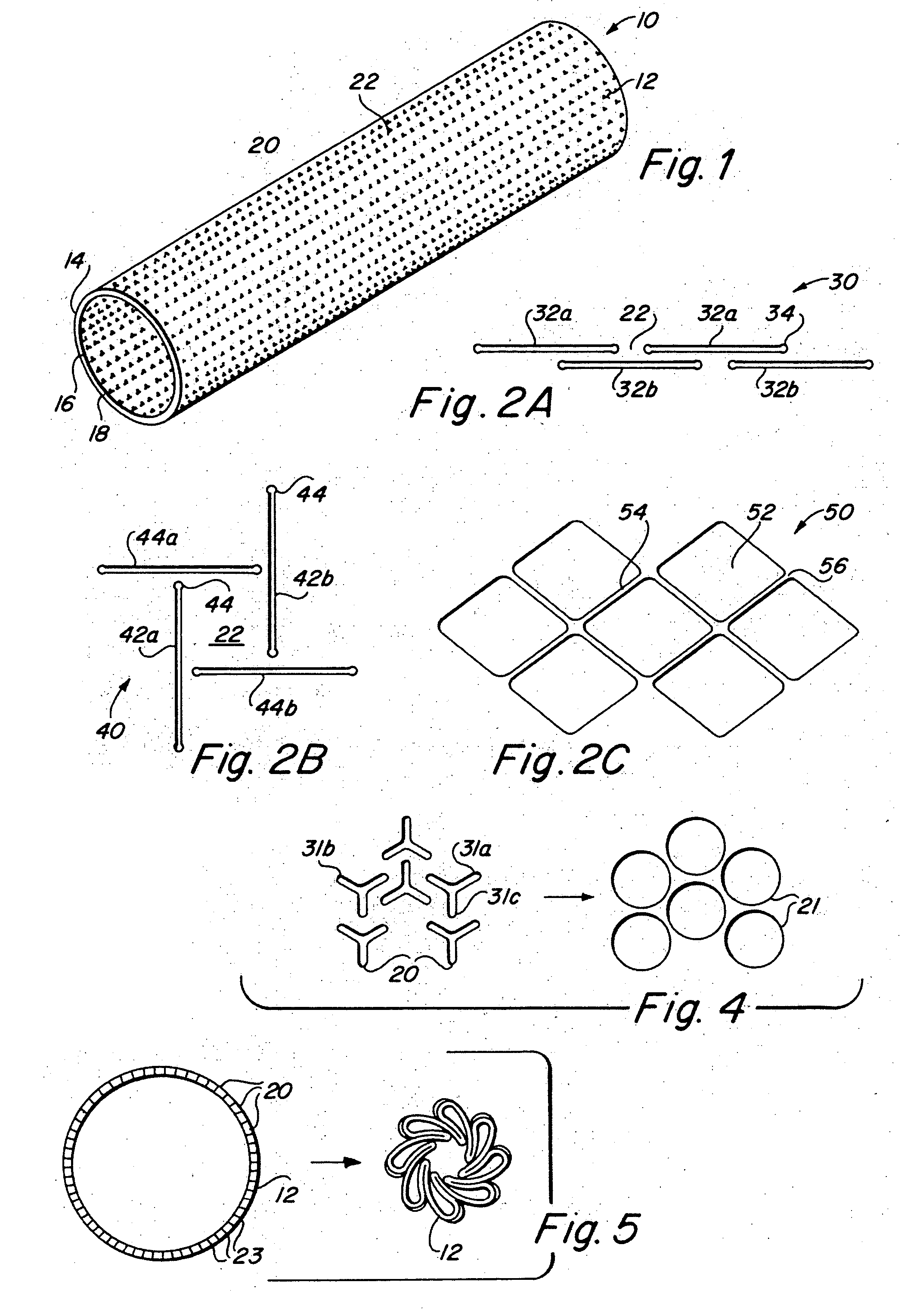 Metallic implantable grafts and method of making same