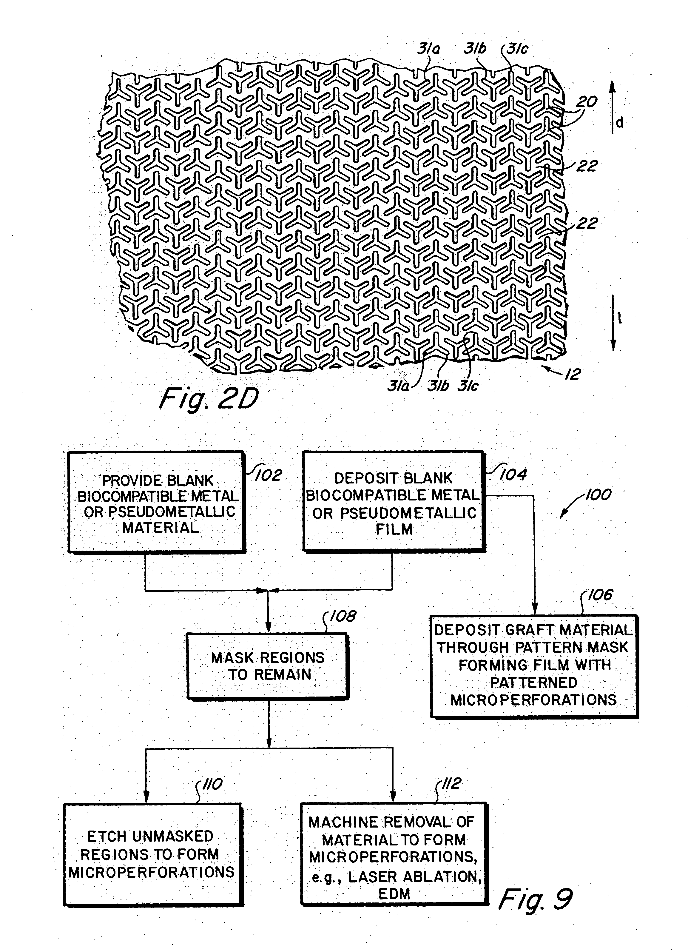 Metallic implantable grafts and method of making same