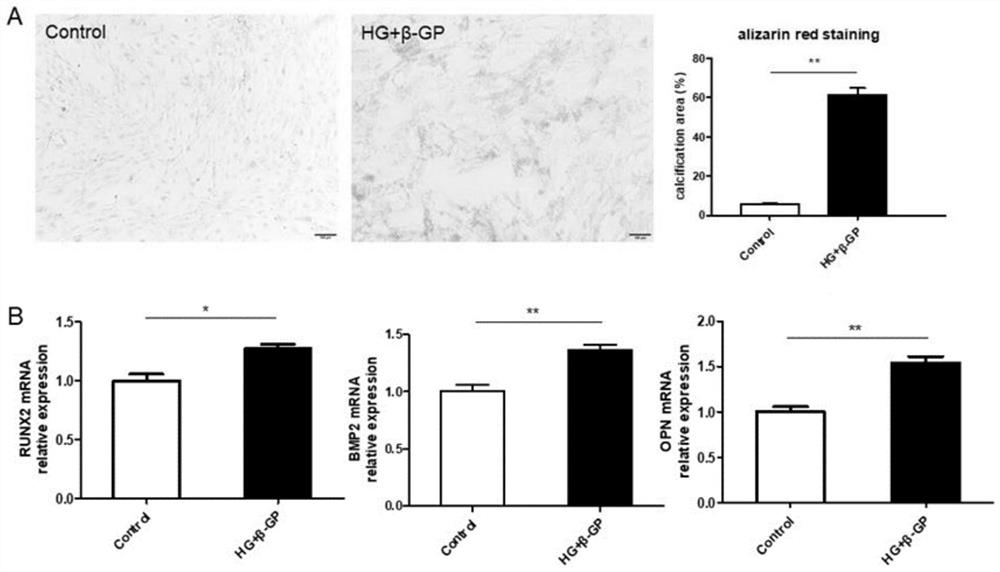 Application of Thonningianin A in preparation of medicine serving as L-type calcium ion channel activator