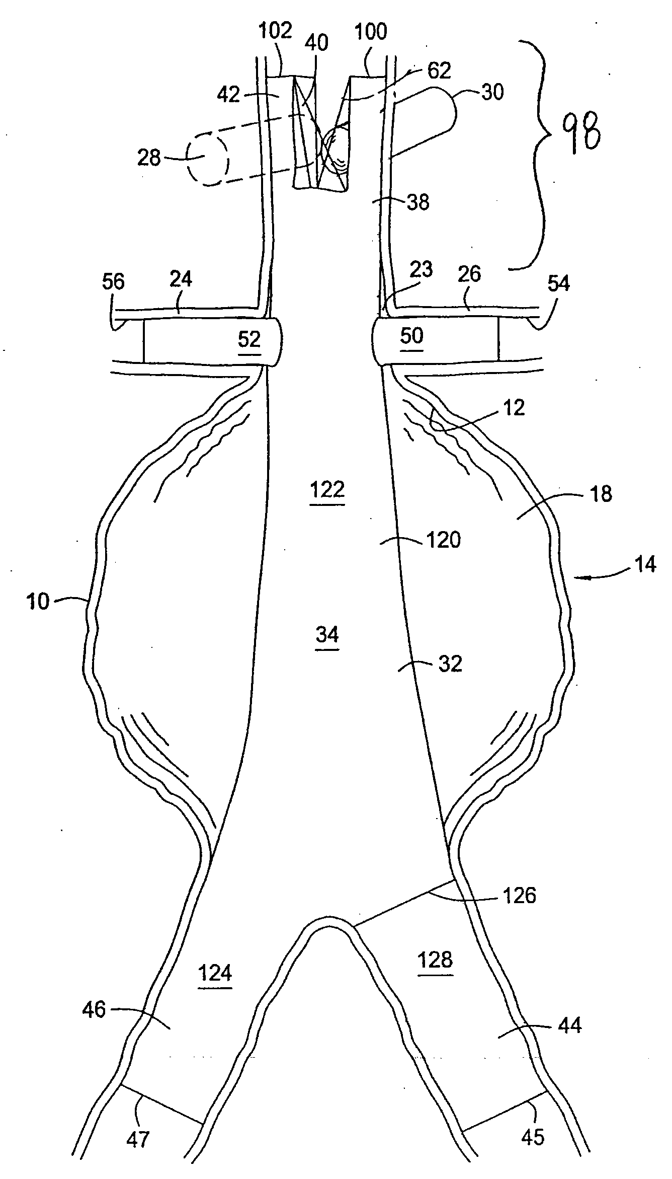 Methods and Apparatus for Treatment of Aneurysms Adjacent to Branch Arteries