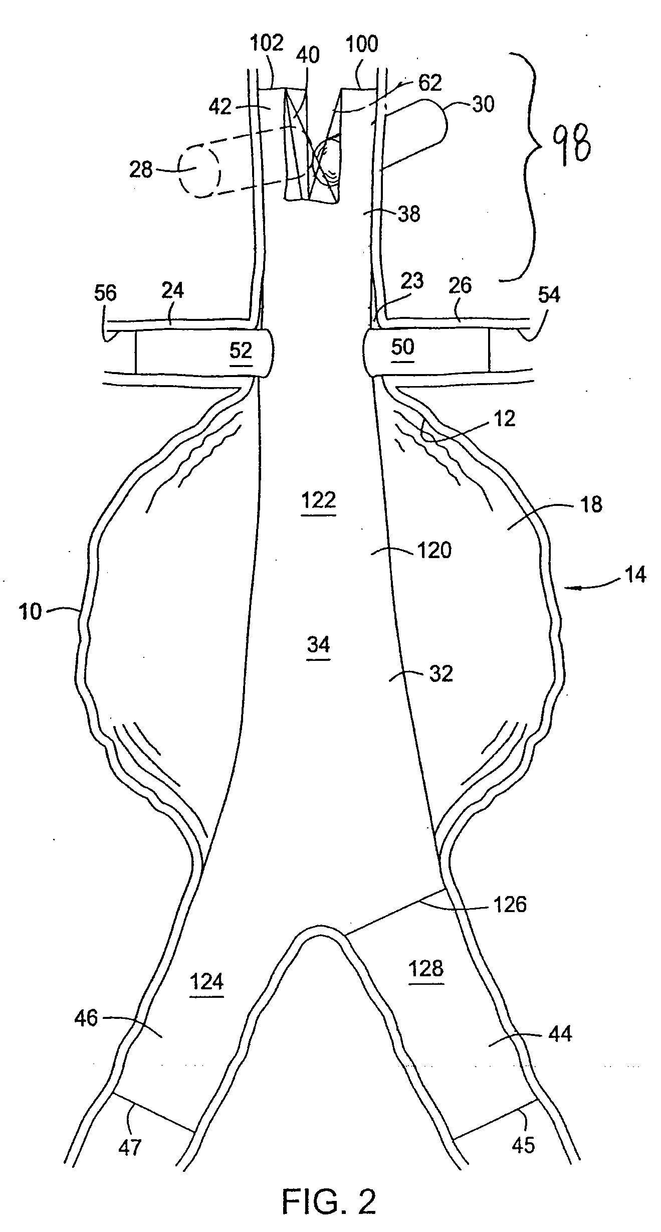 Methods and Apparatus for Treatment of Aneurysms Adjacent to Branch Arteries