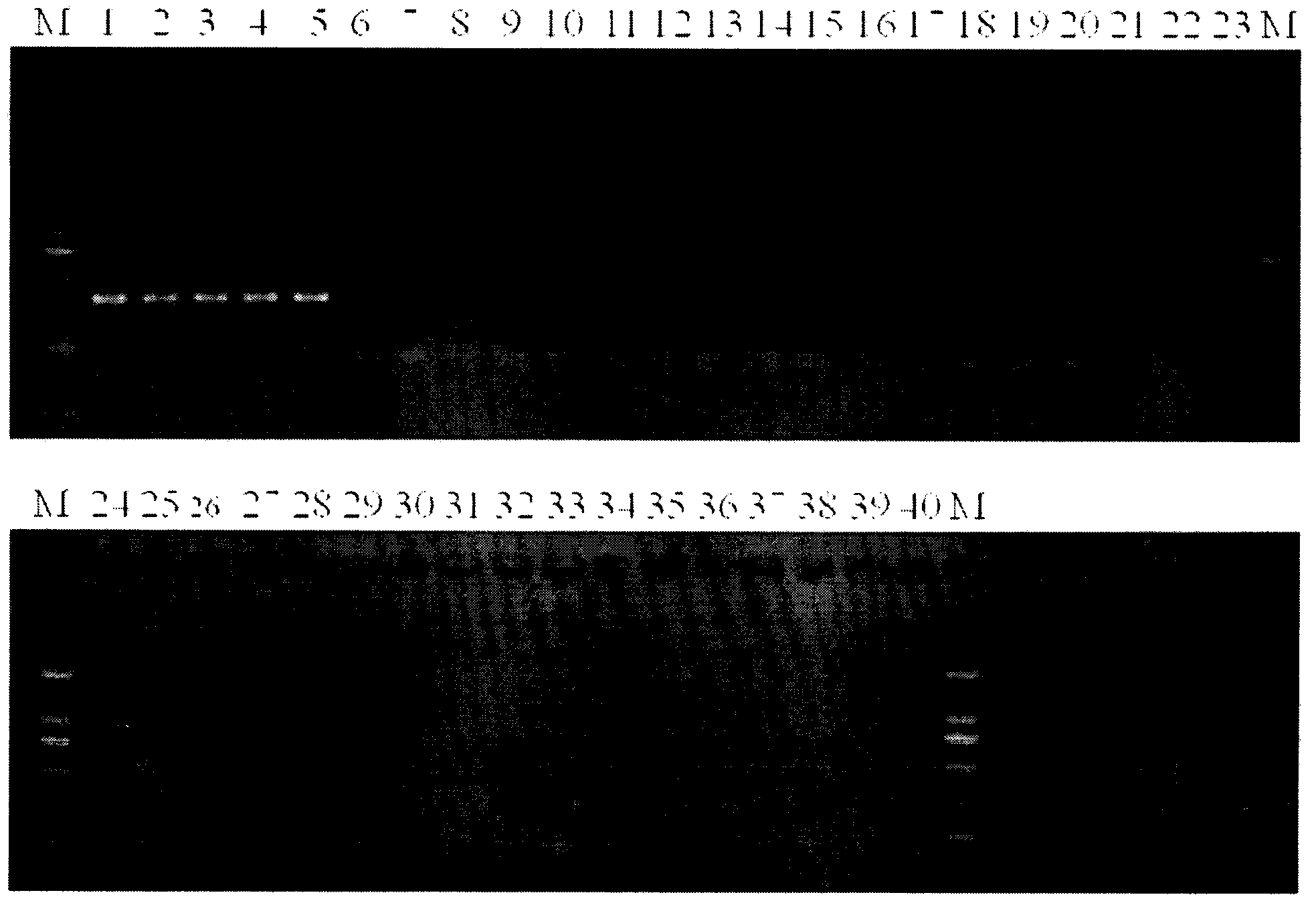 Detection kit and detection method for cabbage oxysporum