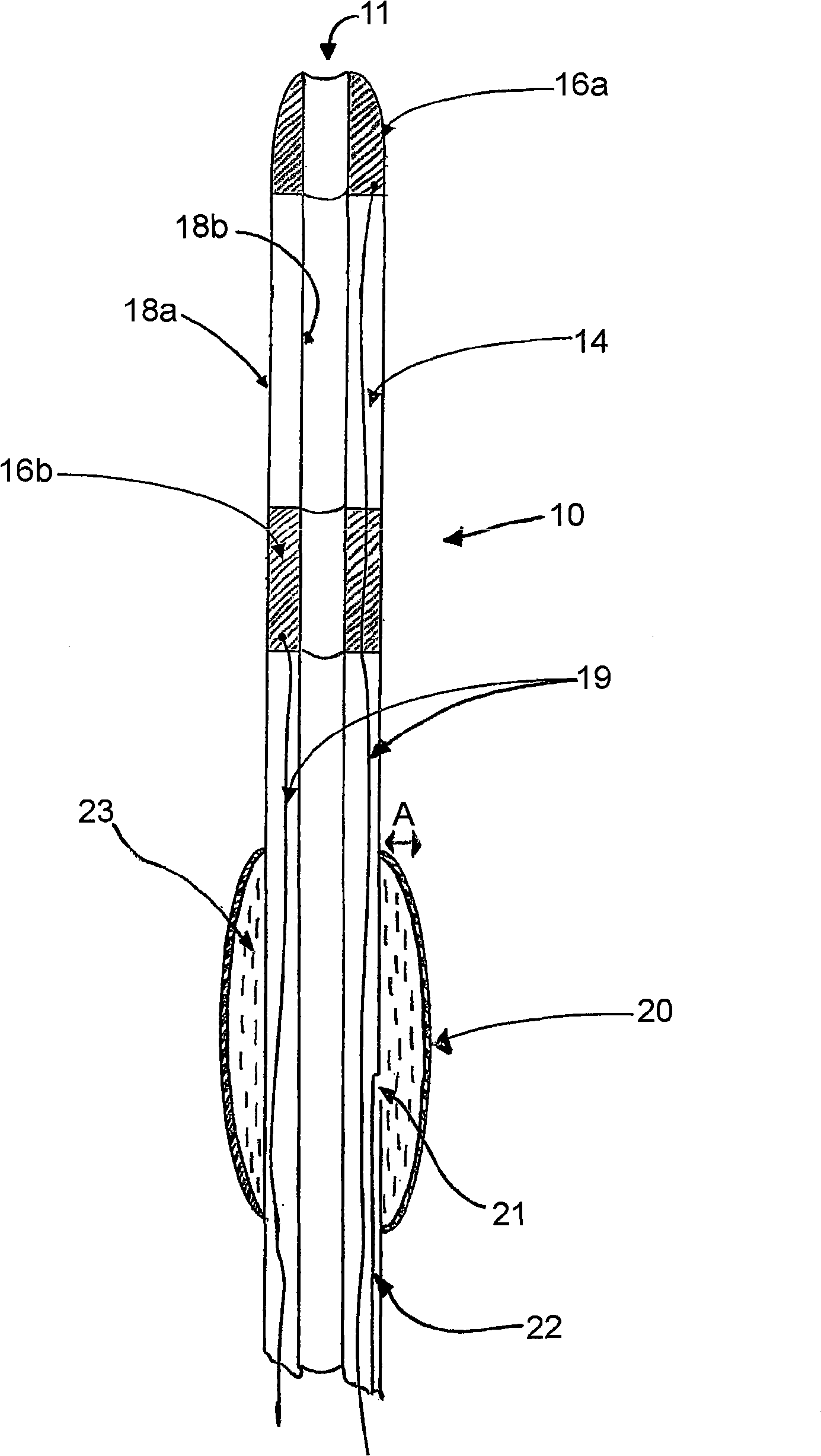 Vessel sealing device and methods