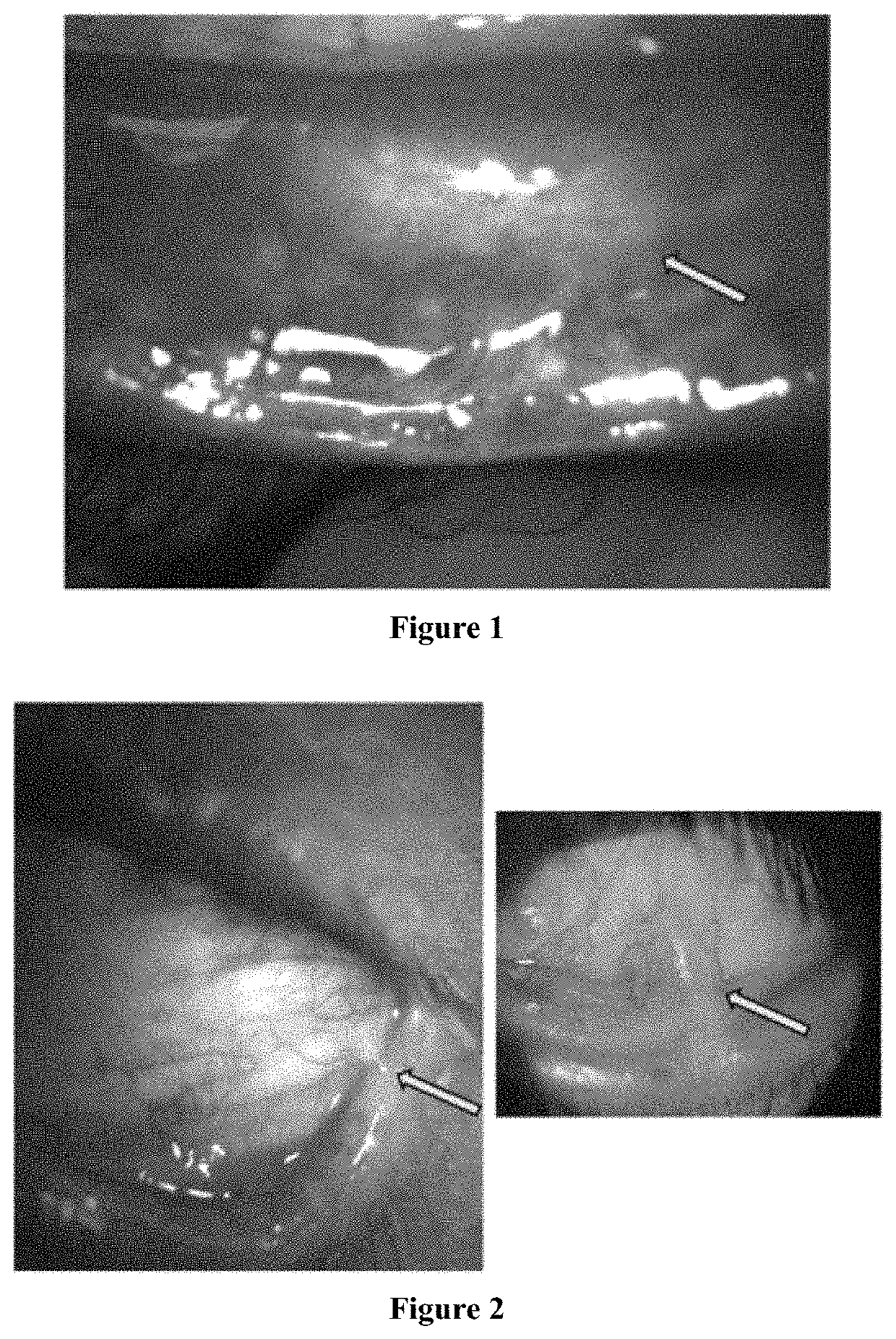 Treatment and diagnosis of ocular surface disorders