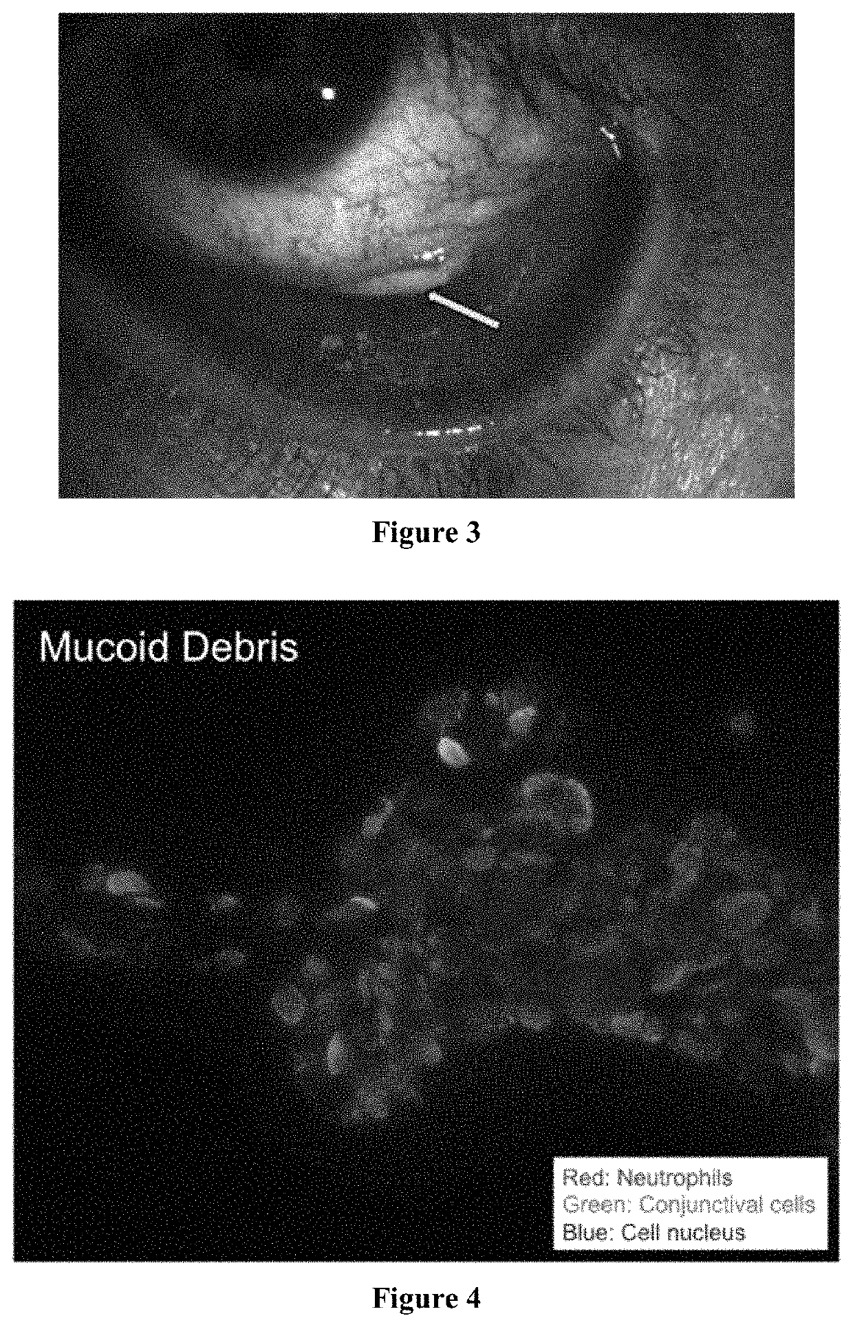 Treatment and diagnosis of ocular surface disorders