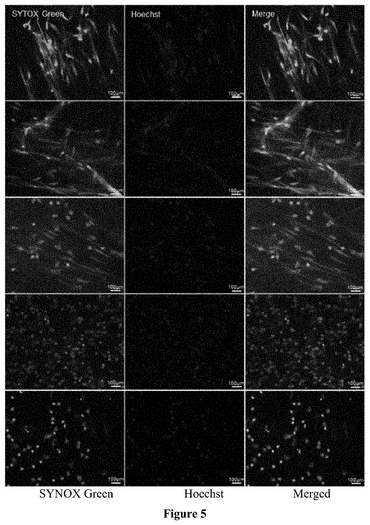 Treatment and diagnosis of ocular surface disorders