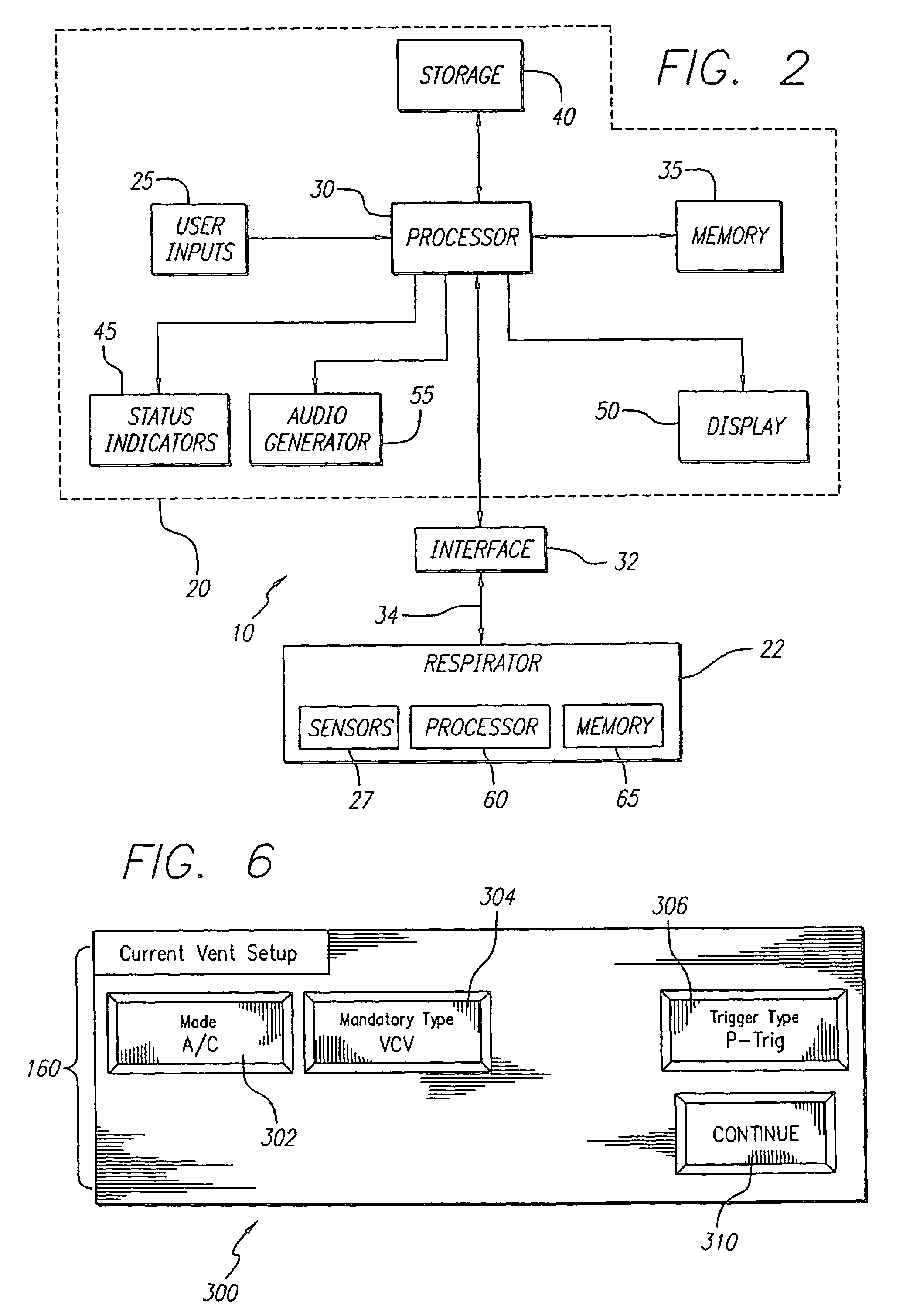 Ventilator breath display and graphic user interface