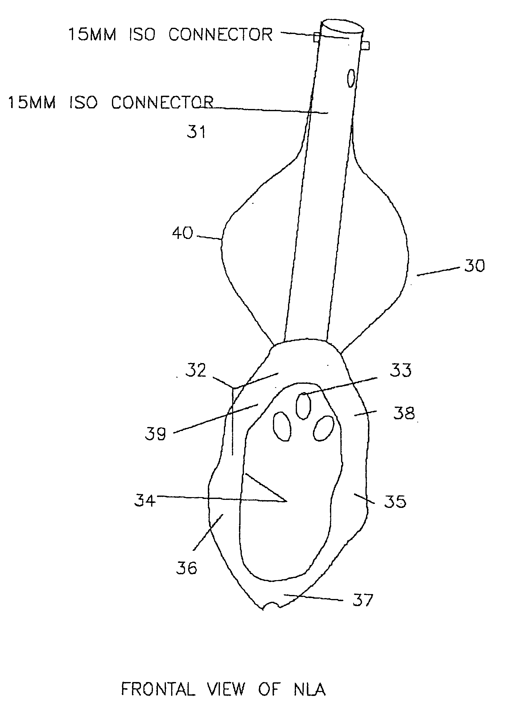 Airway device