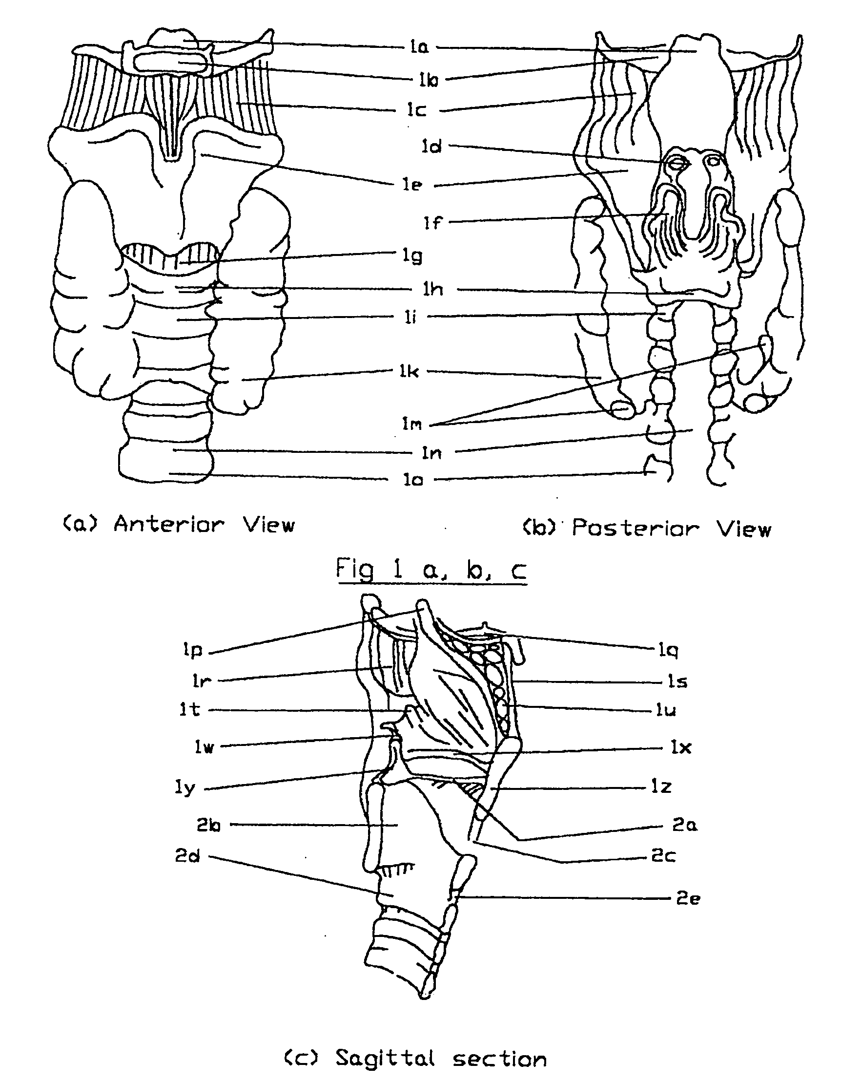 Airway device