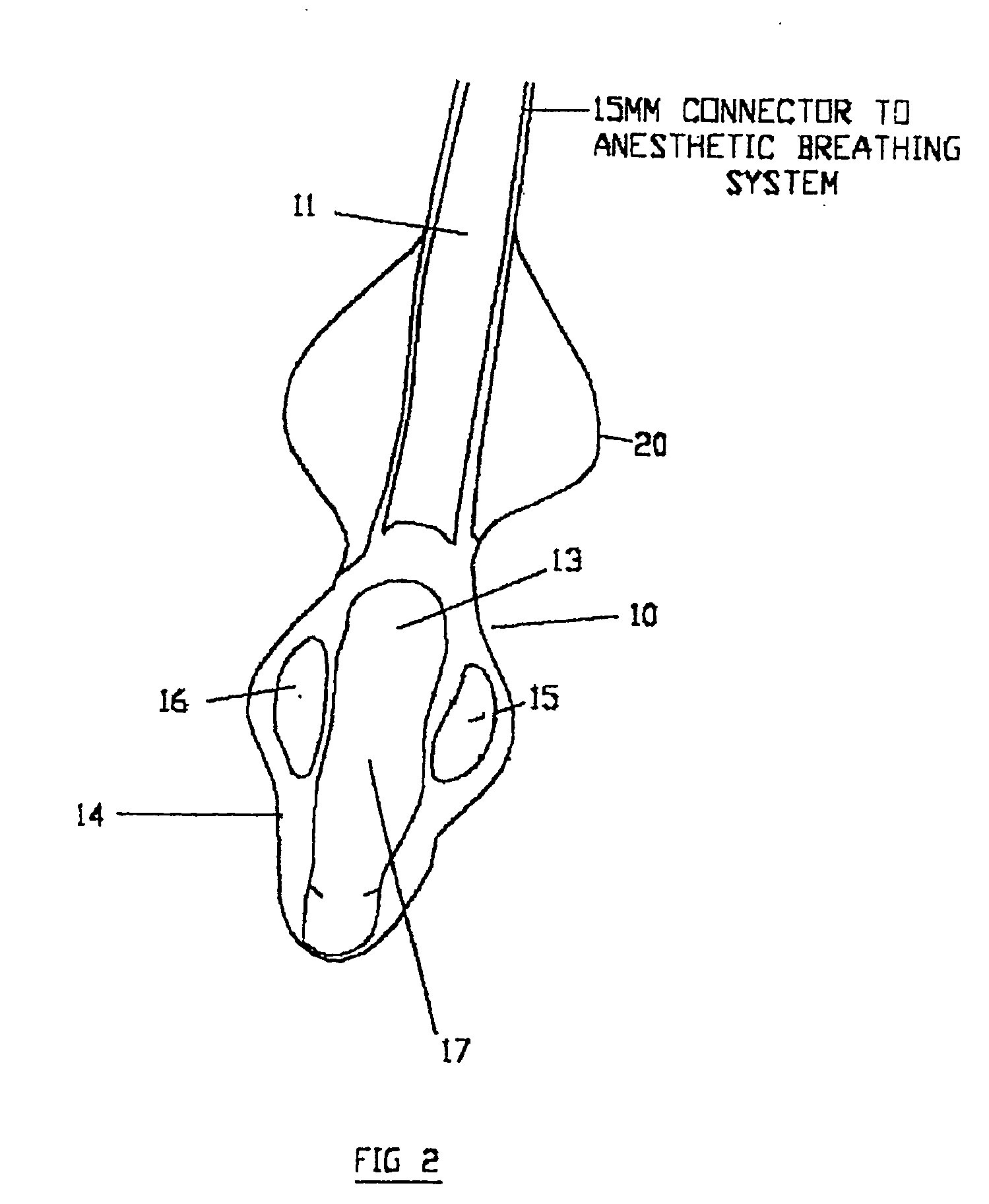 Airway device