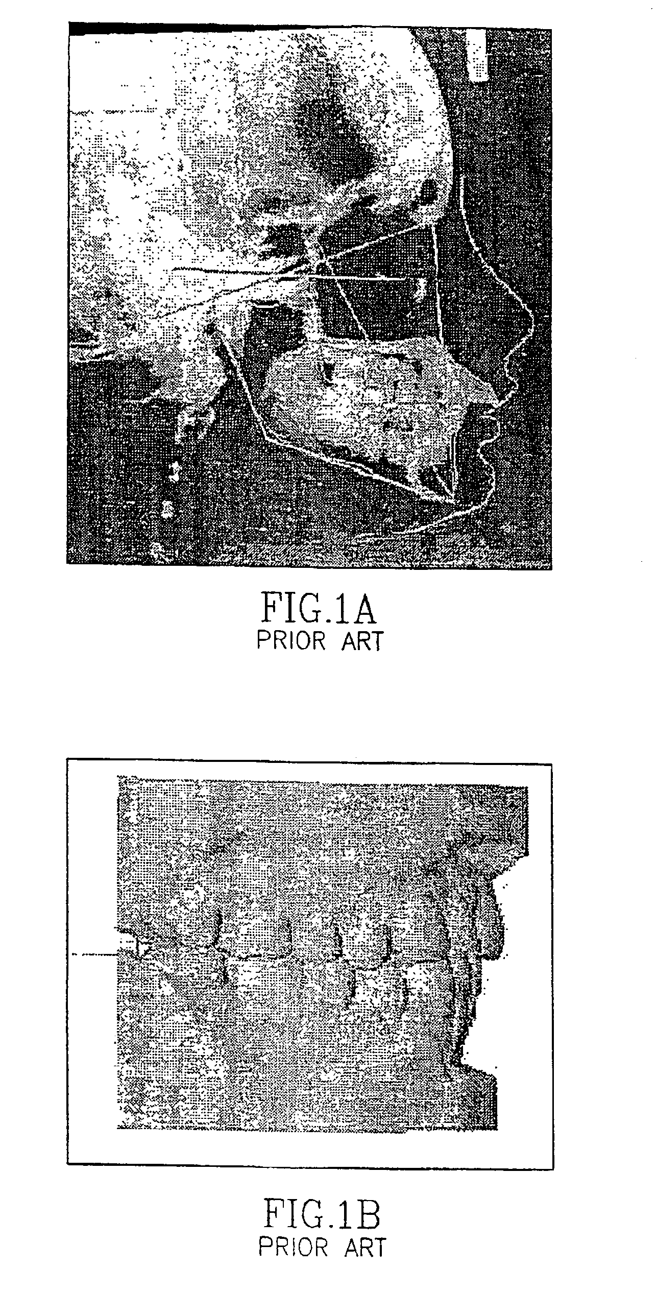 Dental image processing method and system