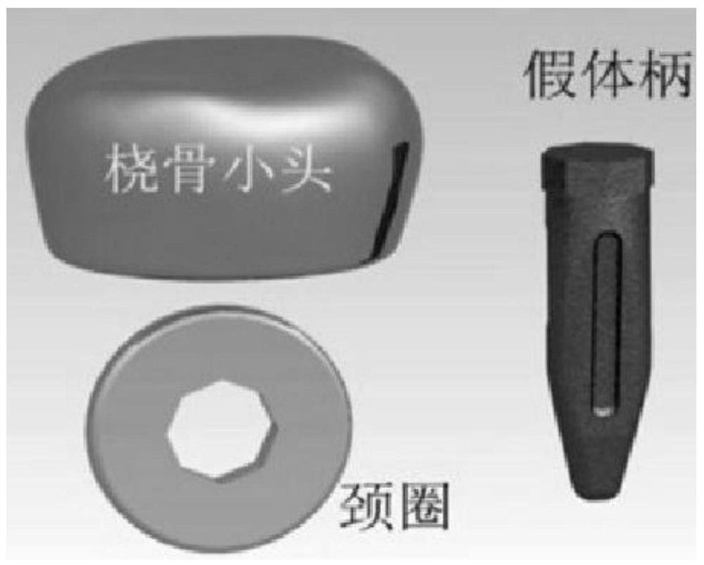 Customized radial head prosthesis based on 3D anatomy of the proximal radius of the unaffected side