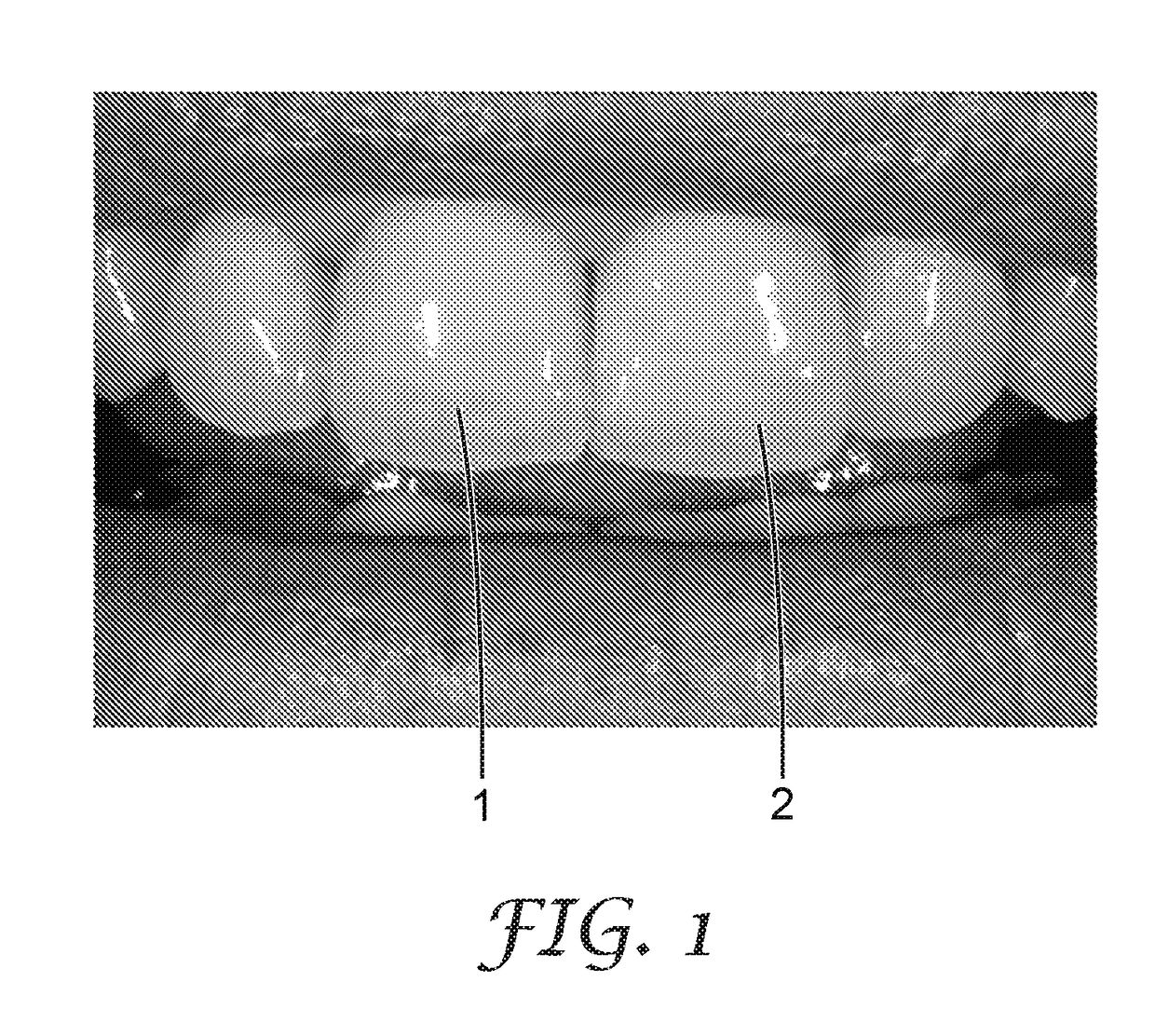 A method of making a dental restoration