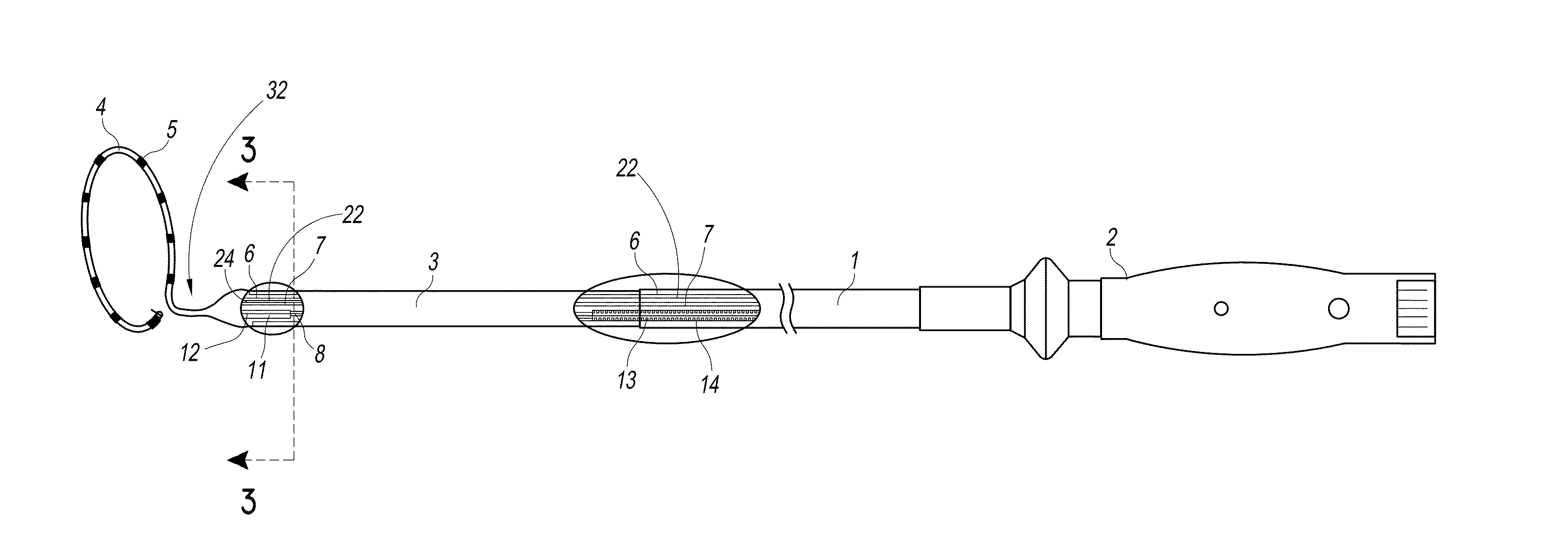 Multi-pole synchronous pulmonary artery radiofrequency ablation catheter