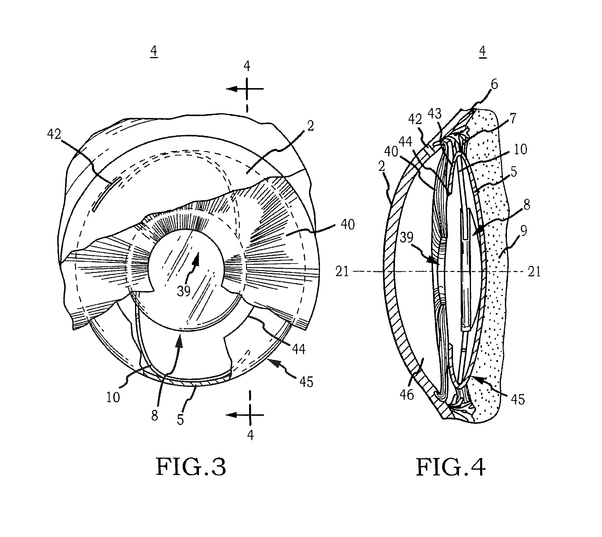 Cell Migration Inhibition System