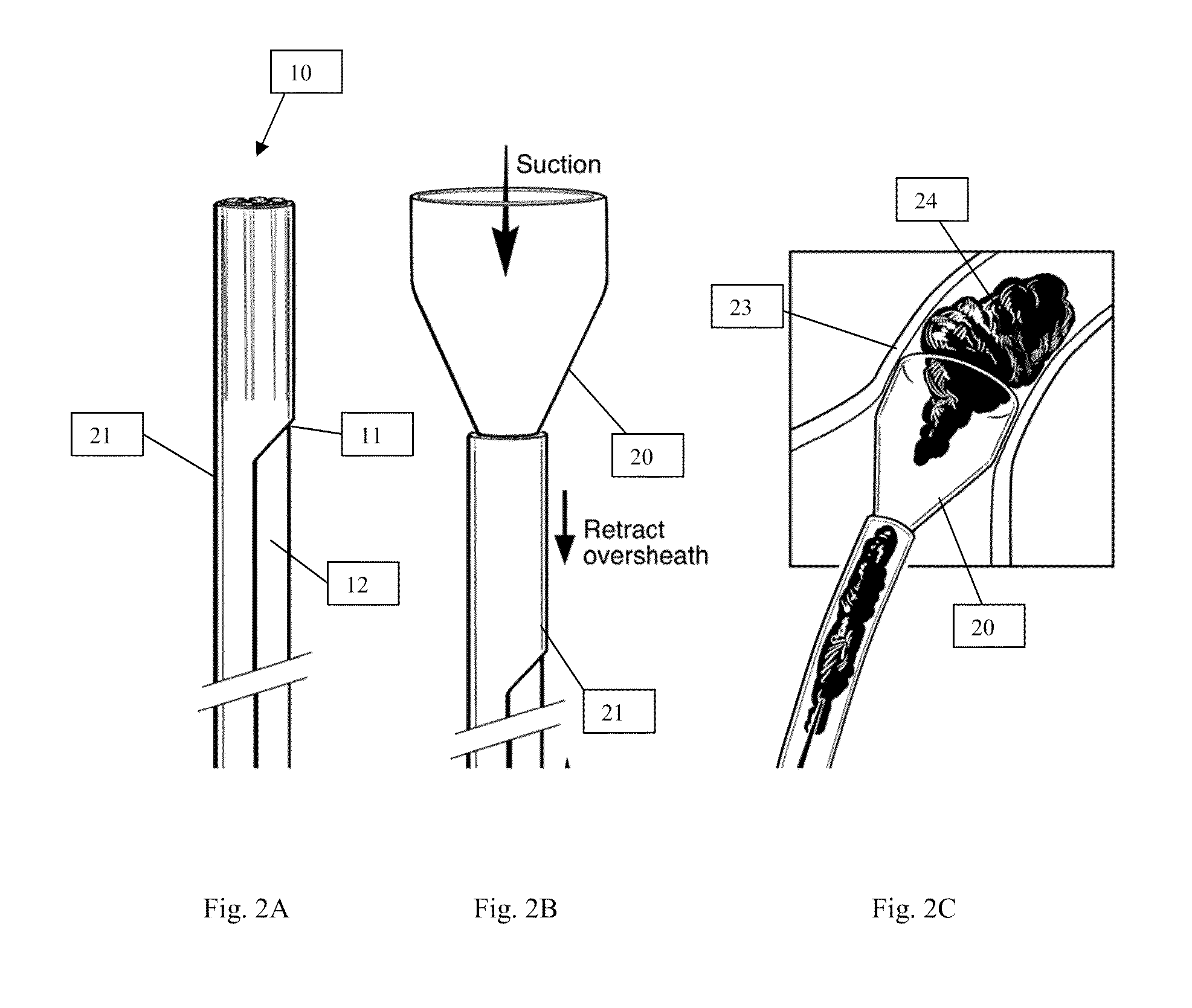 Systems and Methods for Removing Undesirable Material Within a Circulatory System During a Surgical Procedure