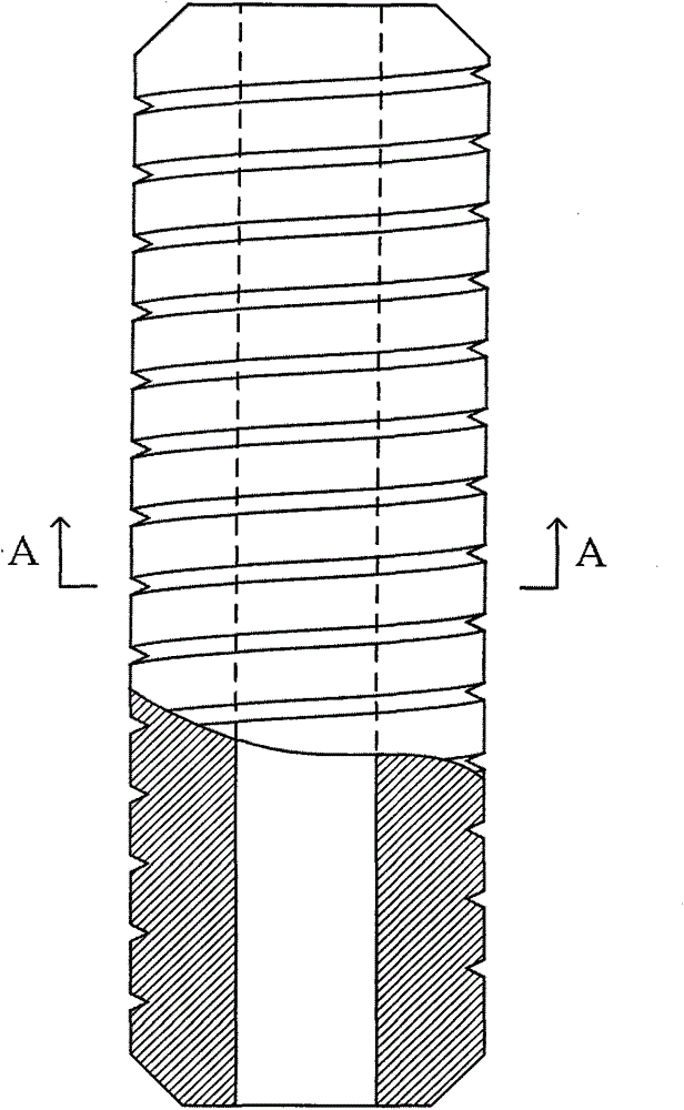 Mineralized collagen-base supporting apparatus for femur head
