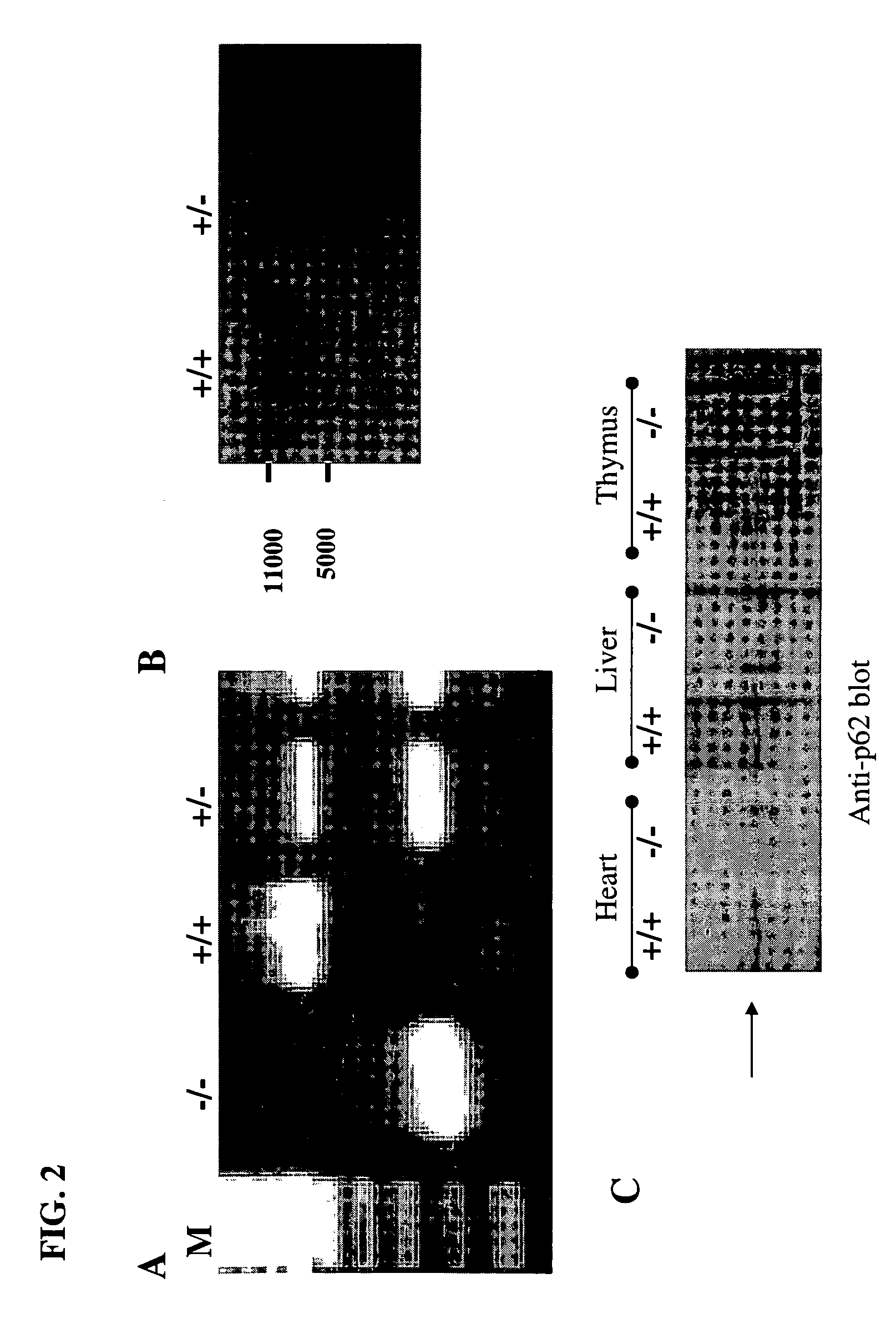 ROLE OF p62 IN AGING-RELATED DISEASE