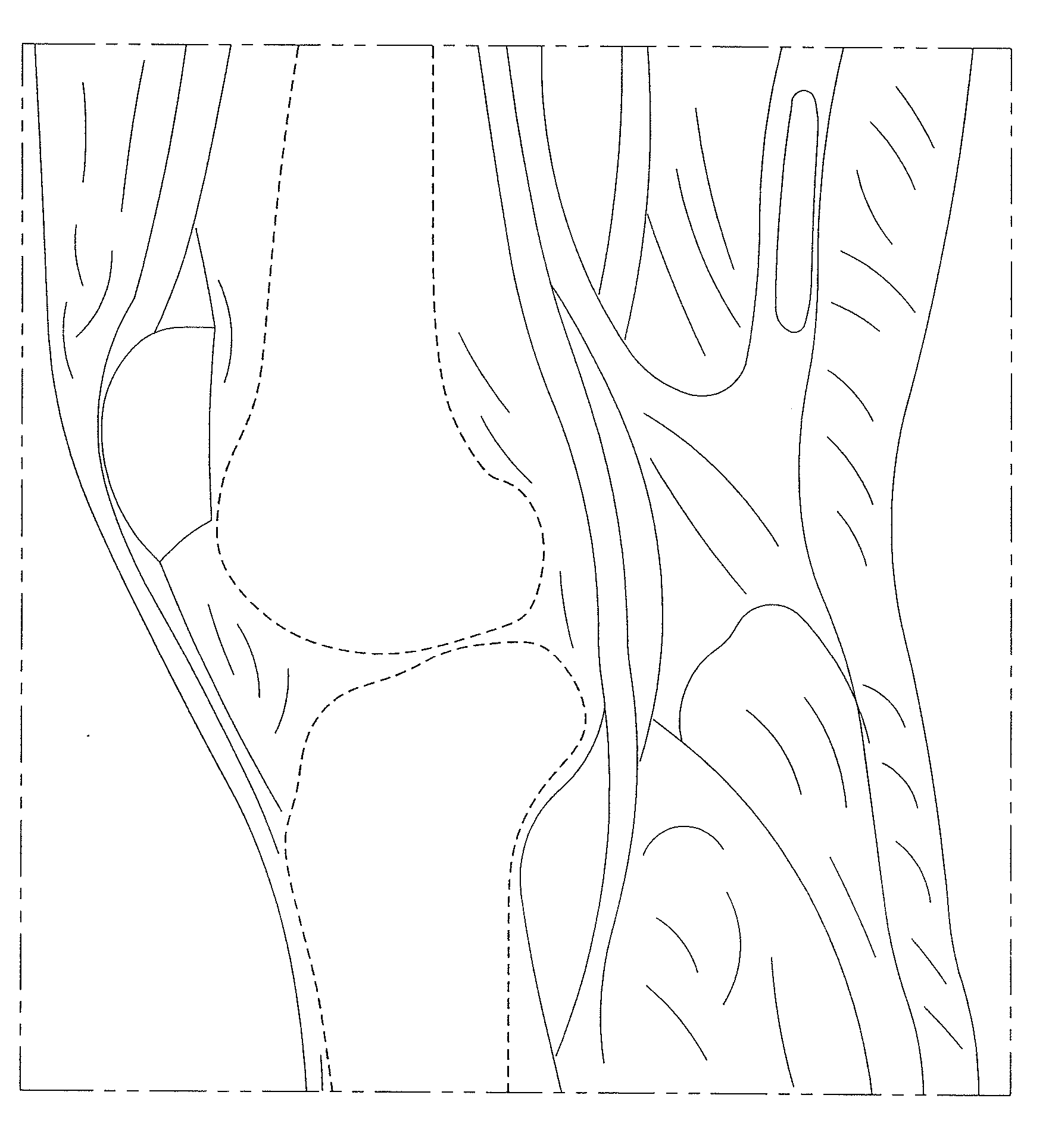 Systems and methods for optimizing parameters of orthopaedic procedures