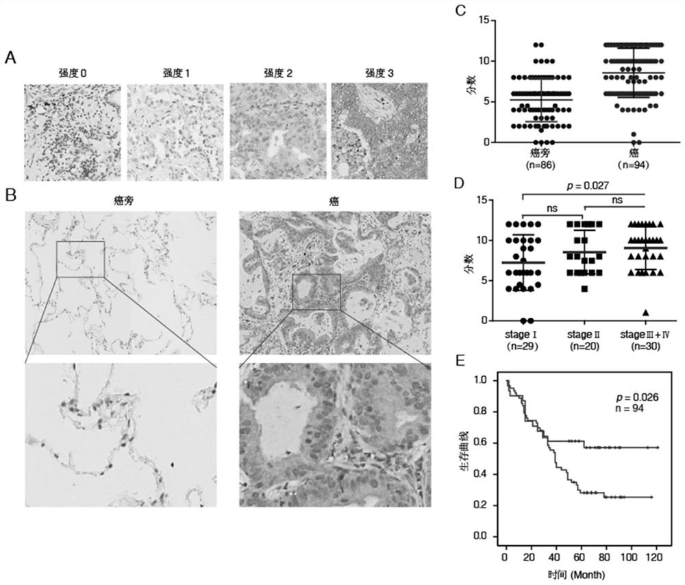 Application of curcumol in the preparation of nqo2 protein inhibitors