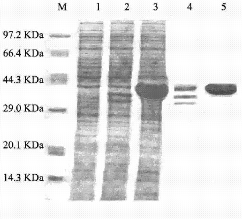 Short-chain dehydrogenase CPE (Cytopathic Effect) gene, coding enzyme, carrier, recombination engineering bacteria and application