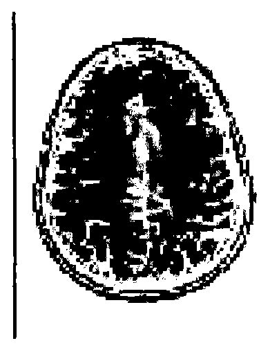 System used for reconstructing and parallelly obtaining mri image