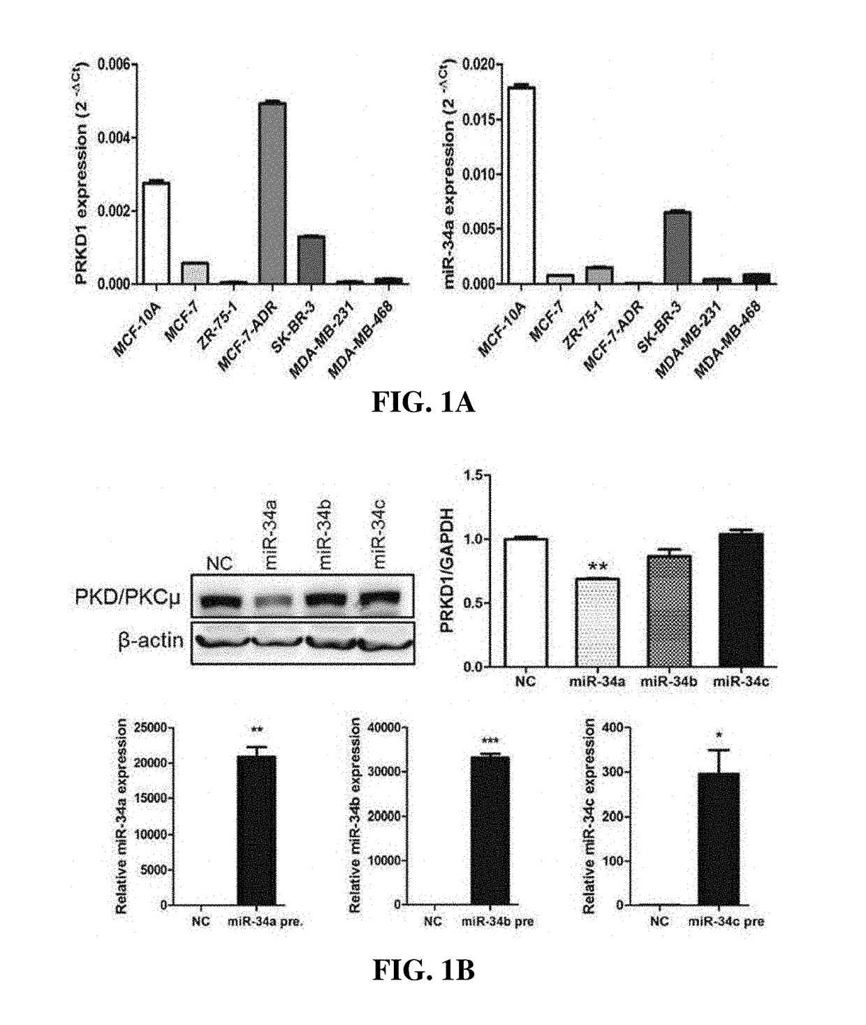 Therapeutic compositions for breast cancer containing protein kinase D1 inhibitor