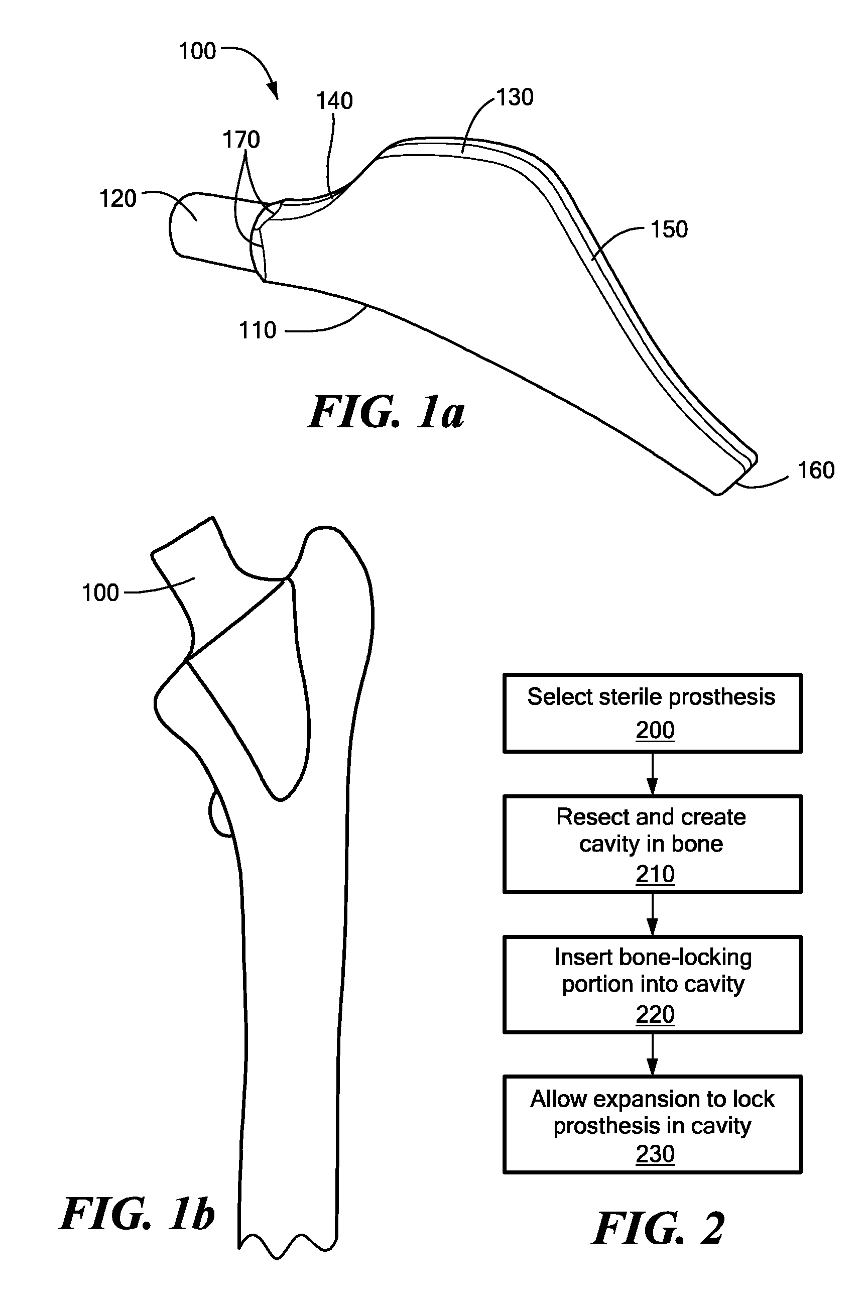 Proximally Self-Locking Long Bone Prosthesis