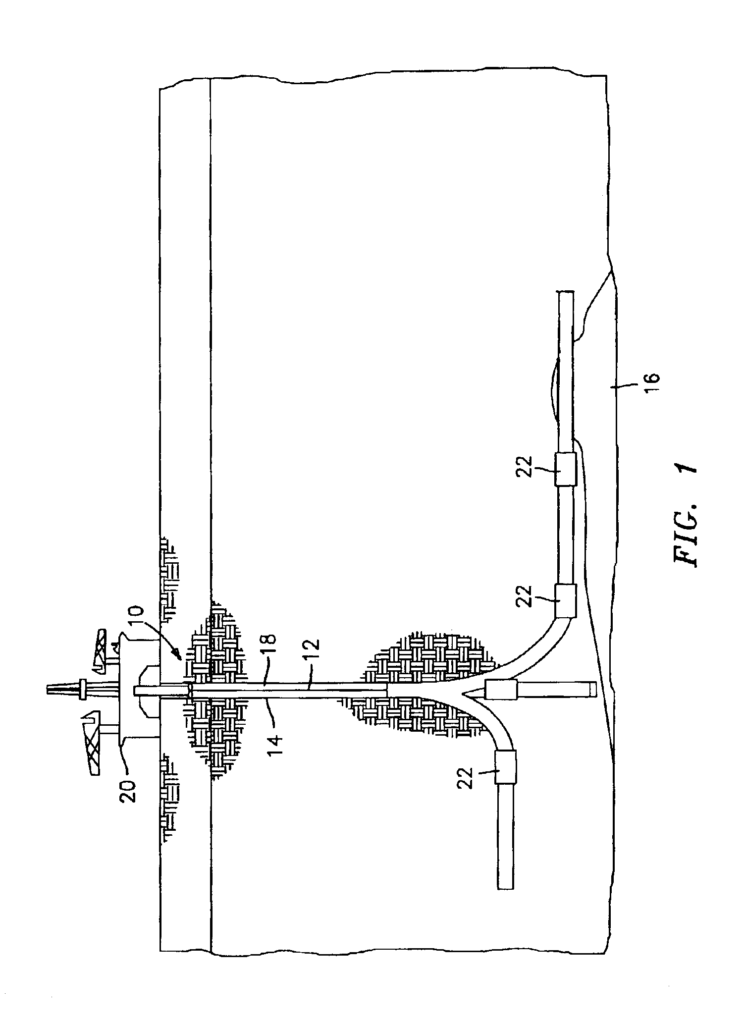 Circumferential strain attenuator