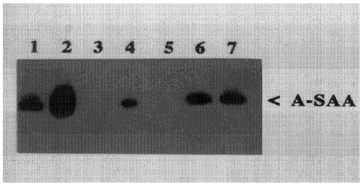 Method for the quantitative measurement of human acute phase serum amyloid A protein; recombinant protein; specific antibody