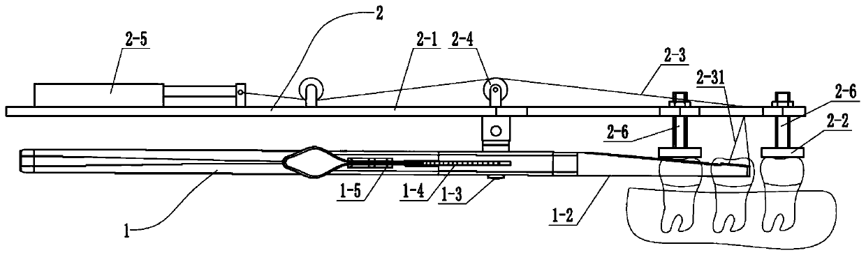 Automatic tooth extraction equipment