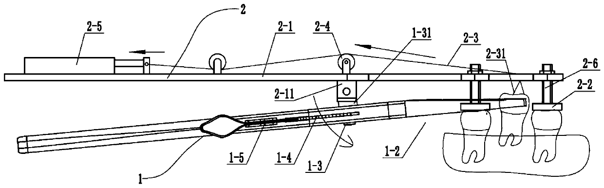 Automatic tooth extraction equipment