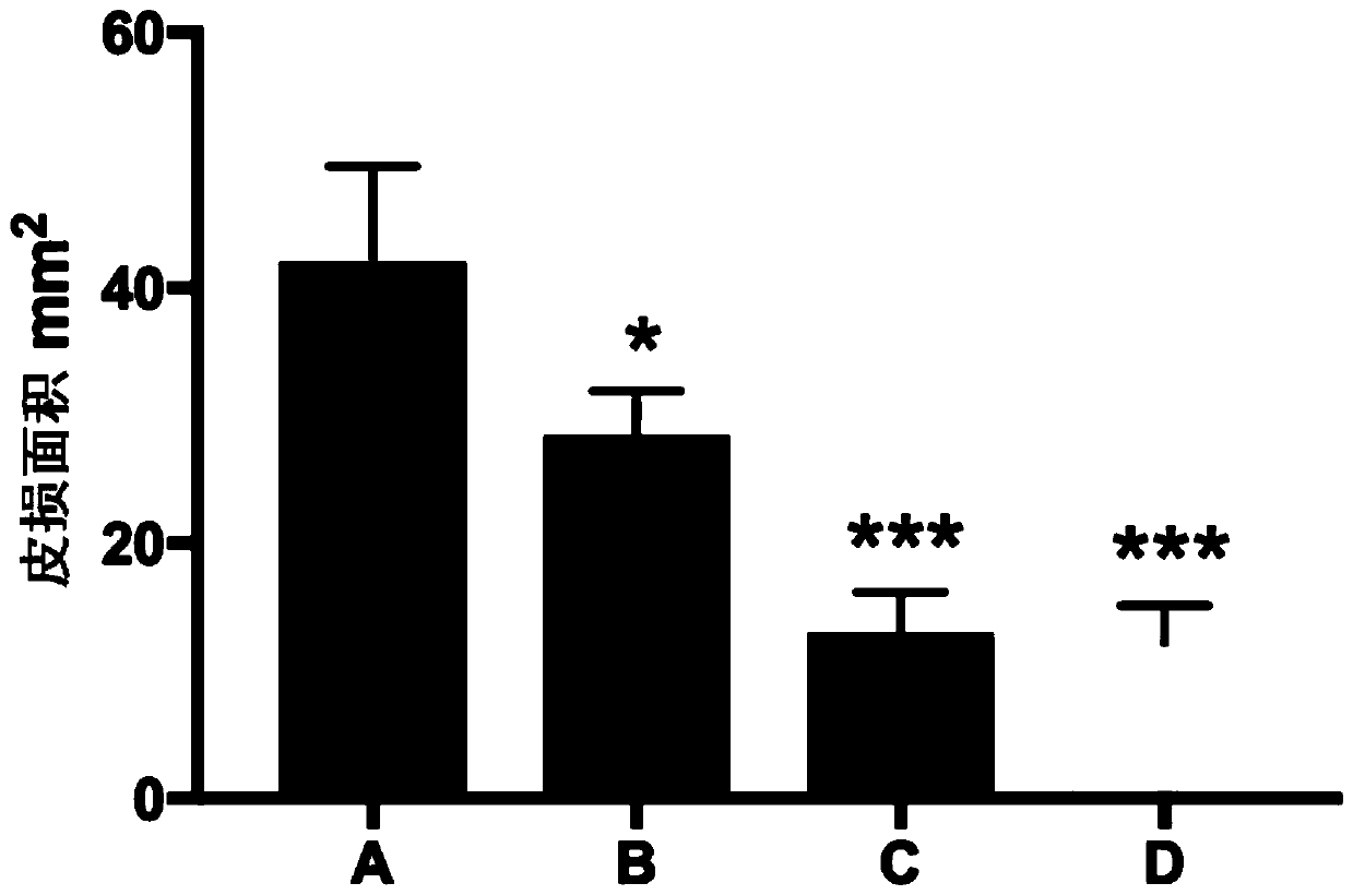 Application of quinine and pharmaceutically acceptable salts thereof to preparation of drug for treating AD (atopic dermatitis)