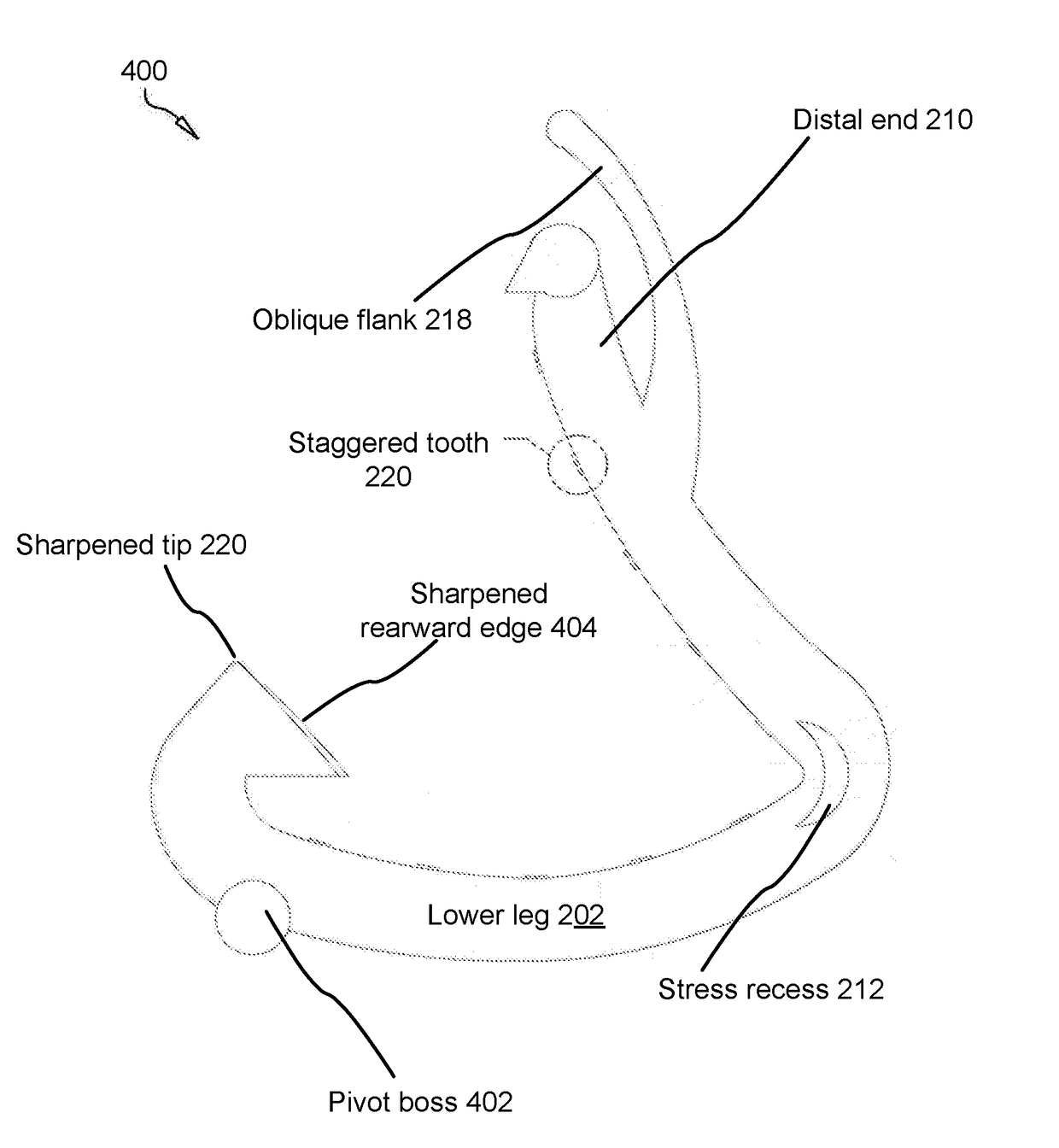 Surgical ligation clip