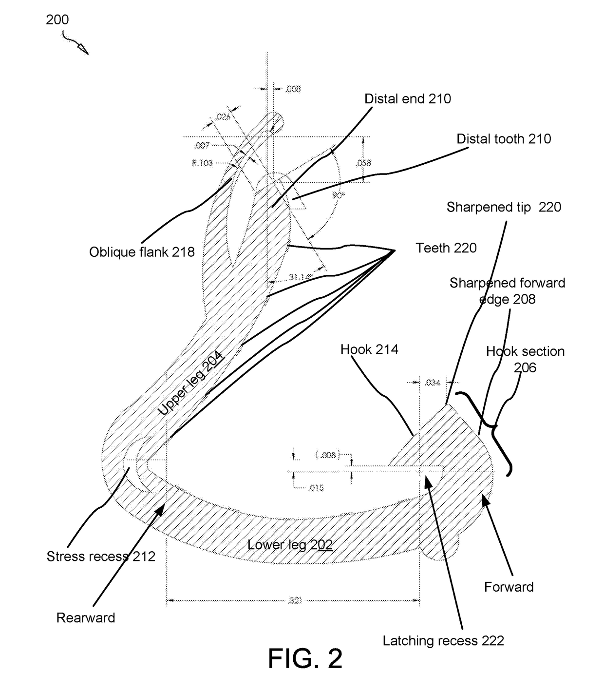 Surgical ligation clip