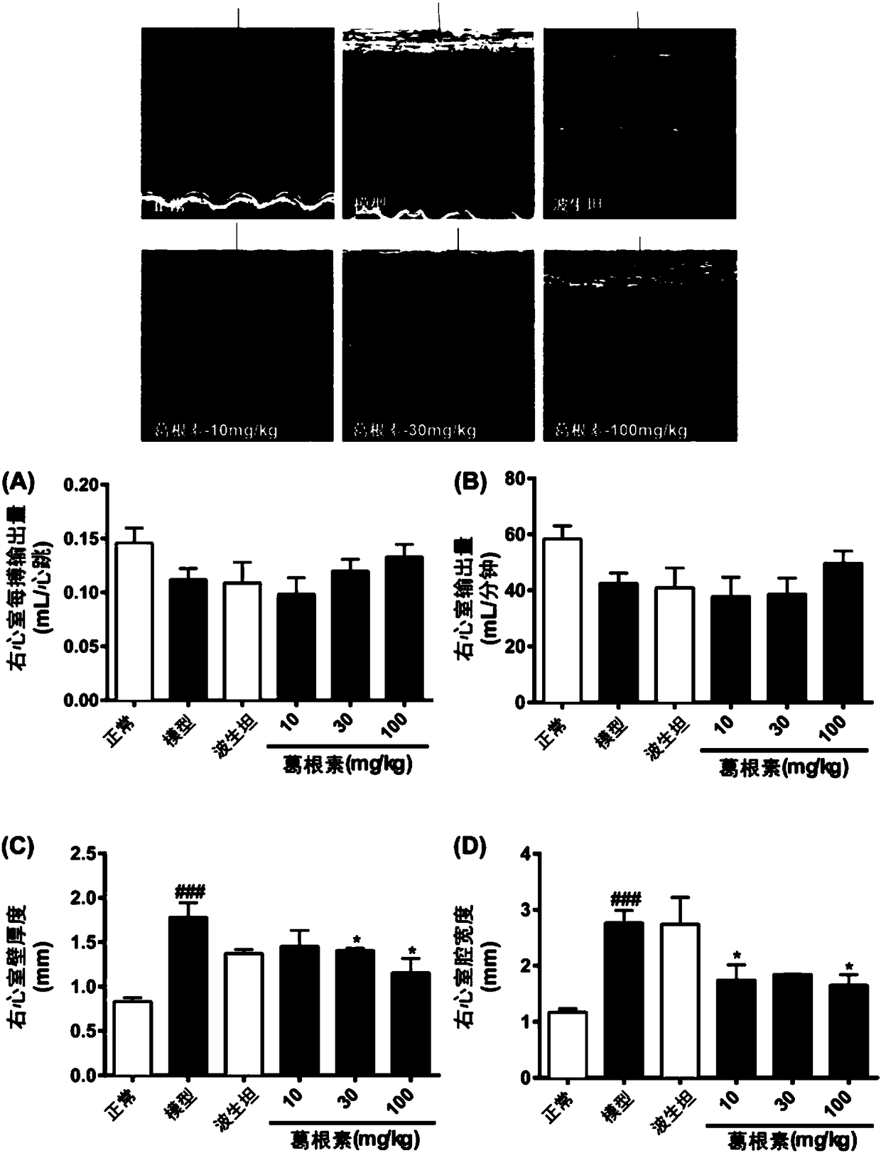 Application of puerarin in preparation of drugs for preventing and/or treating pulmonary arterial hypertension and complications thereof