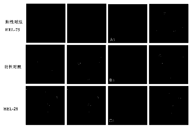 Human epididymal expression sperm binding protein HEL-28 as well as encoding gene and application thereof