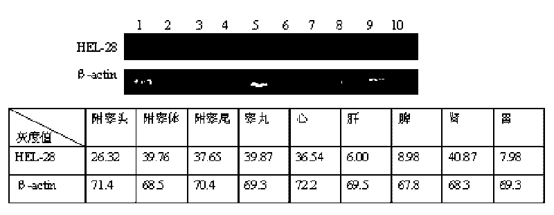 Human epididymal expression sperm binding protein HEL-28 as well as encoding gene and application thereof