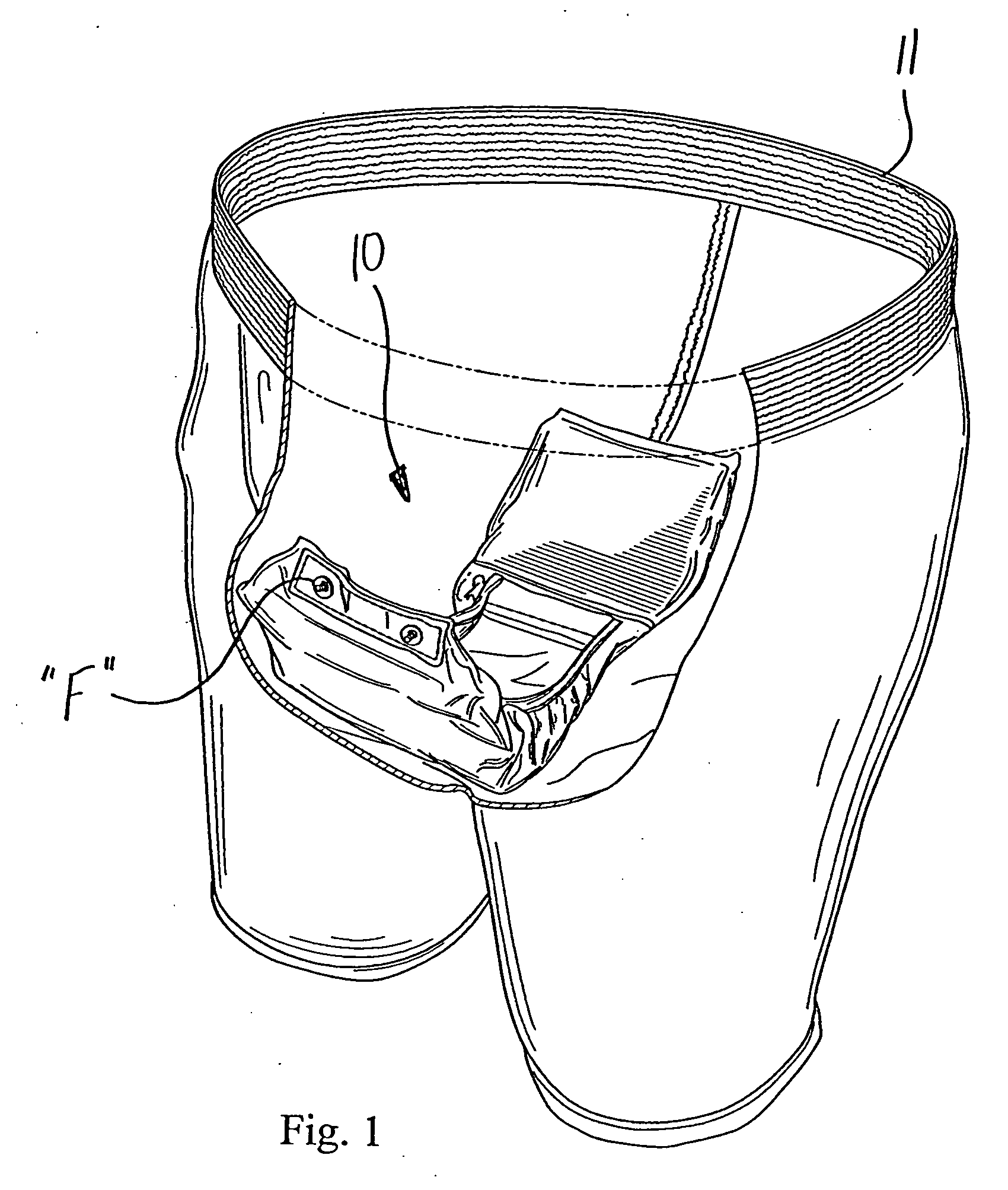 Moisture management incontinence device