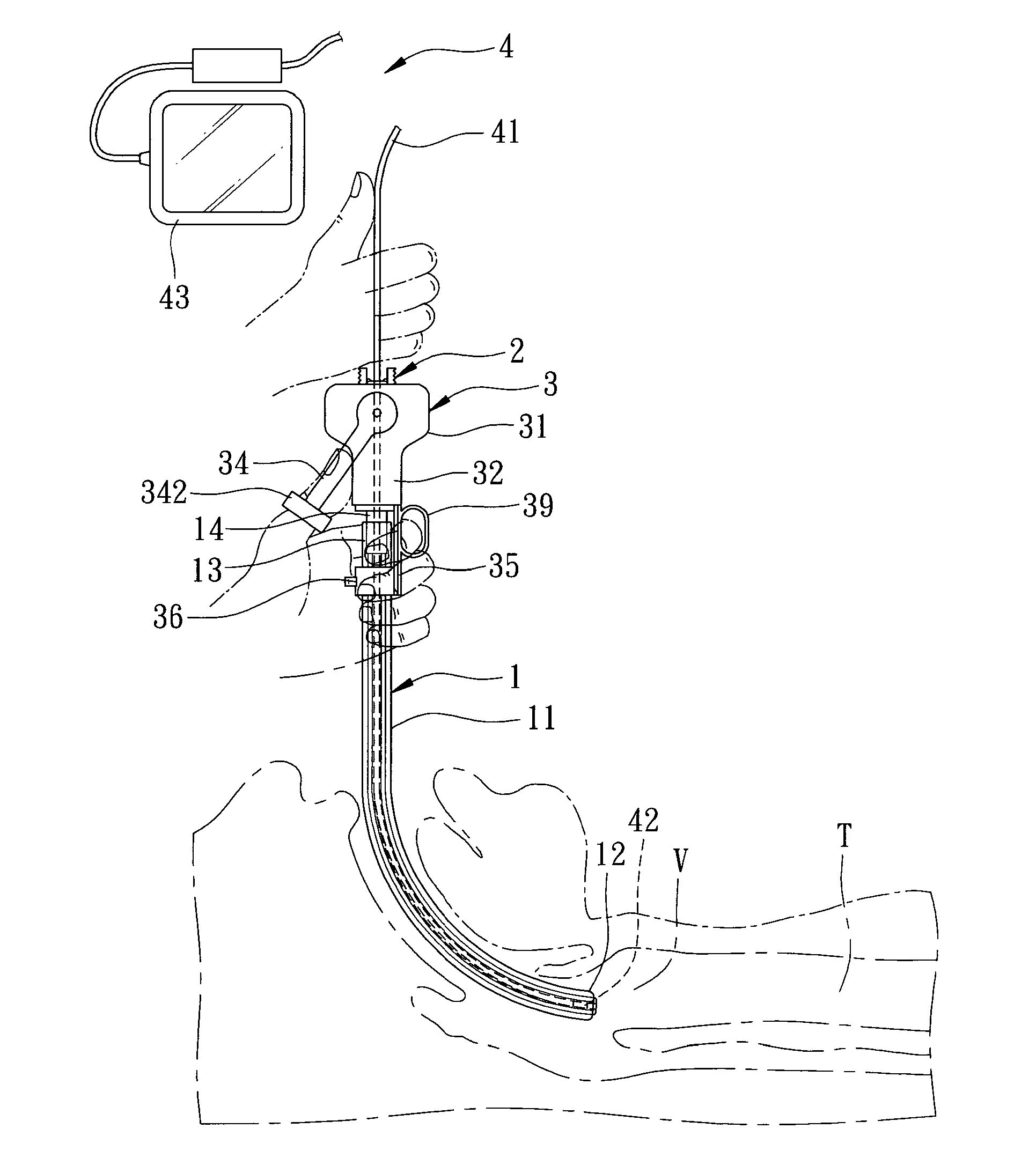 Endotracheal intubation assistance apparatus