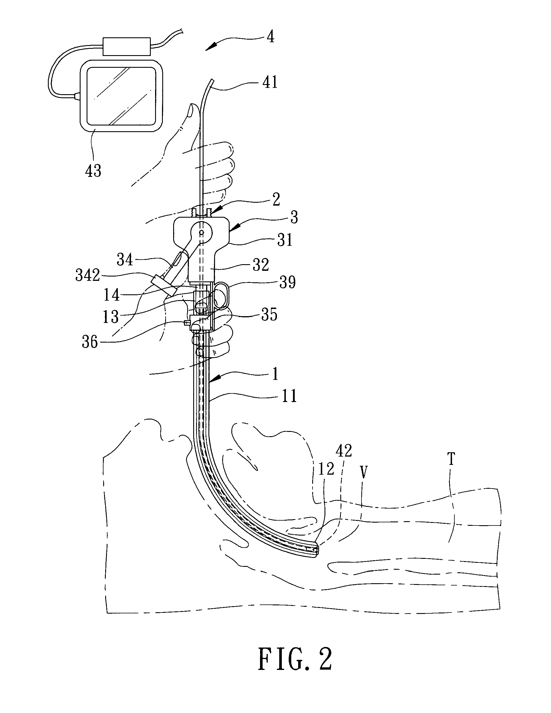 Endotracheal intubation assistance apparatus