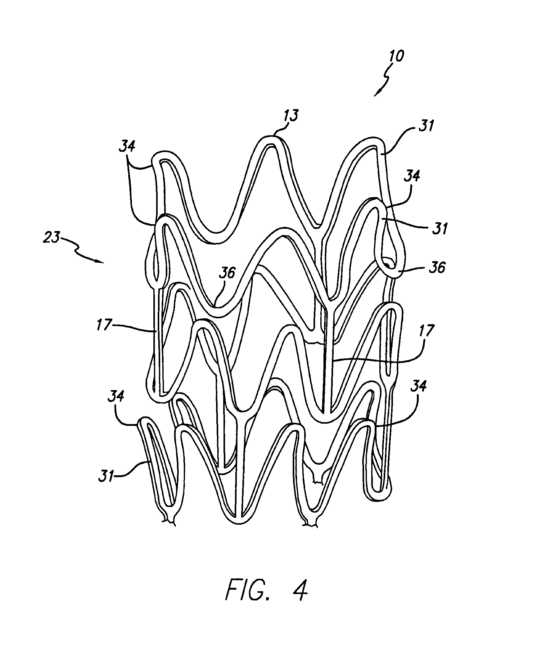 Stent for treating vulnerable plaque