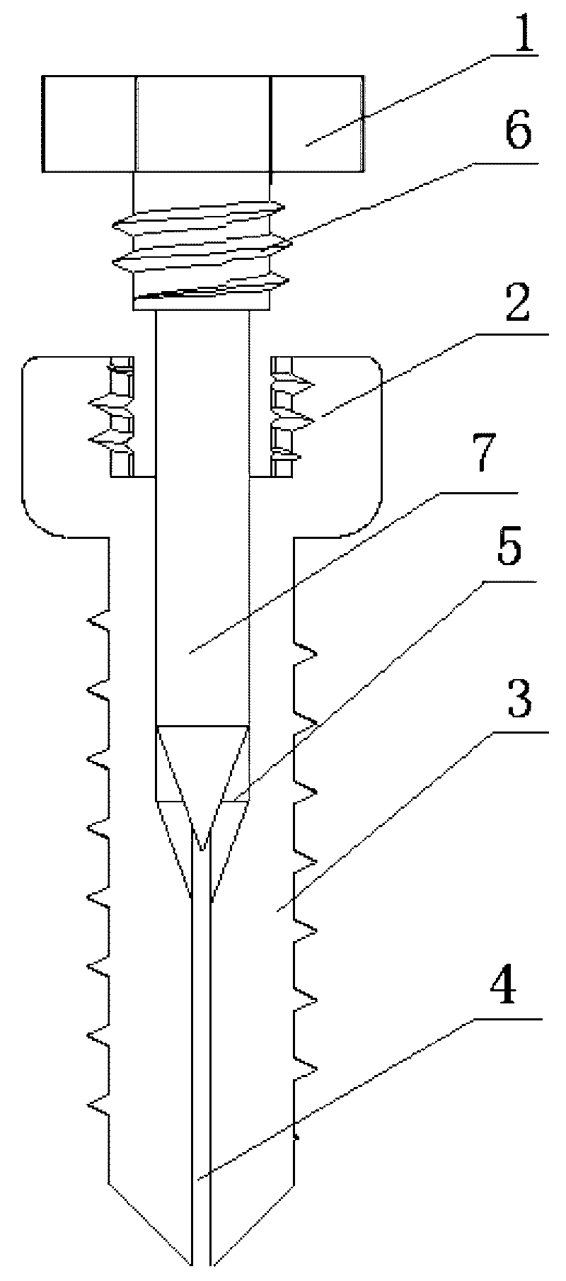 Expansive orthodontic anchorage implant