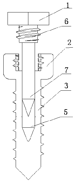 Expansive orthodontic anchorage implant