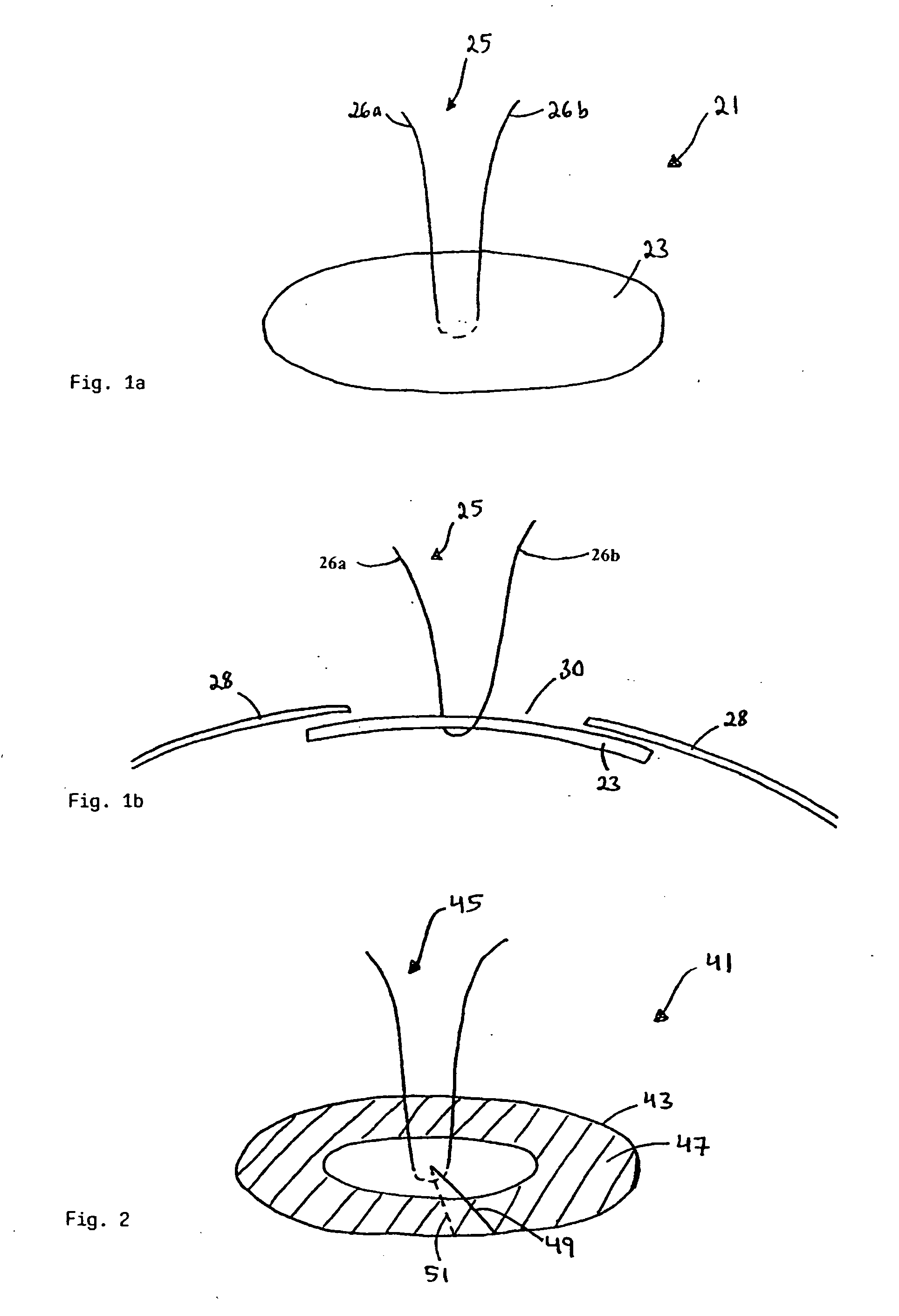 Device for use in eye surgery