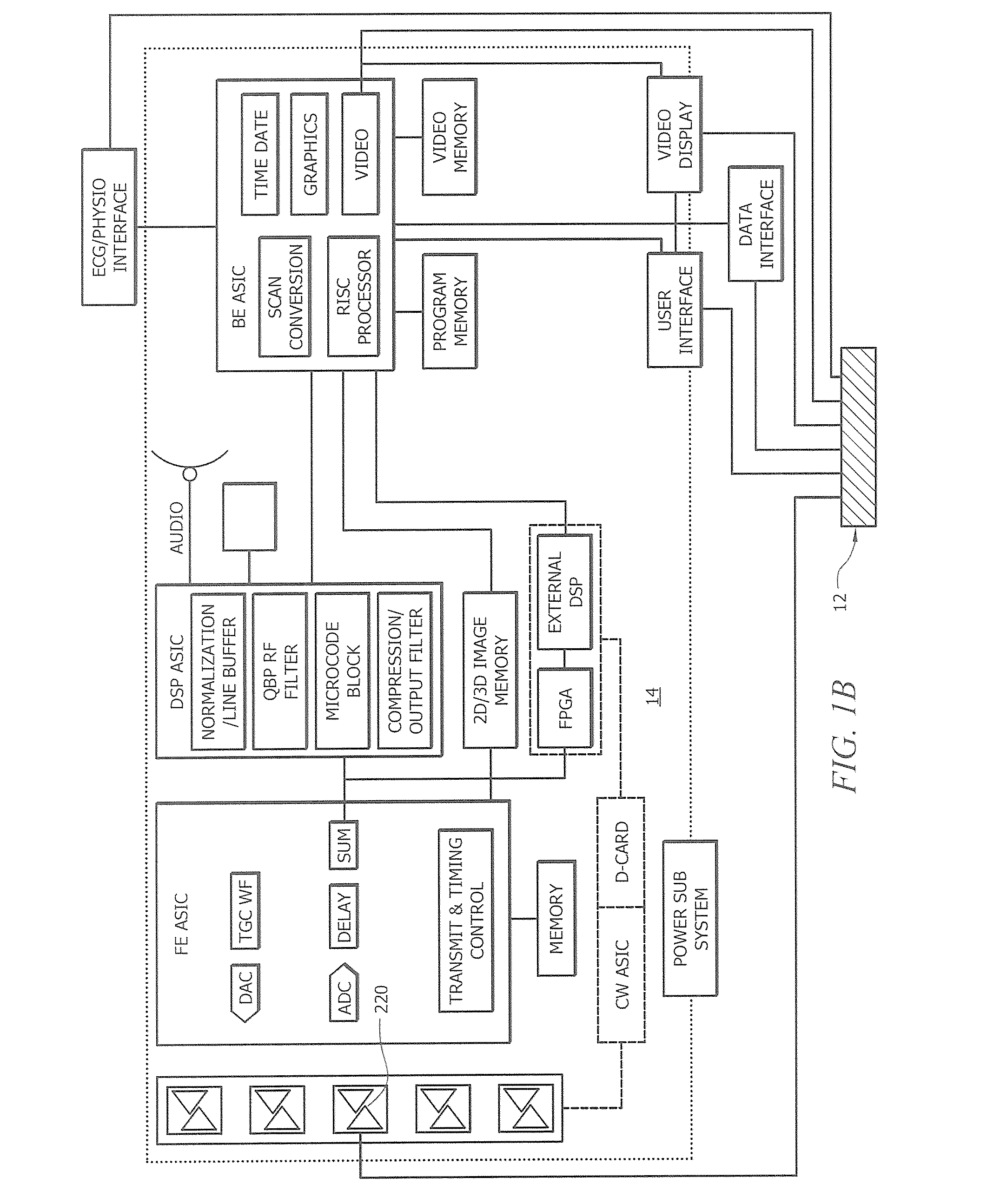 Modular apparatus for diagnostic ultrasound