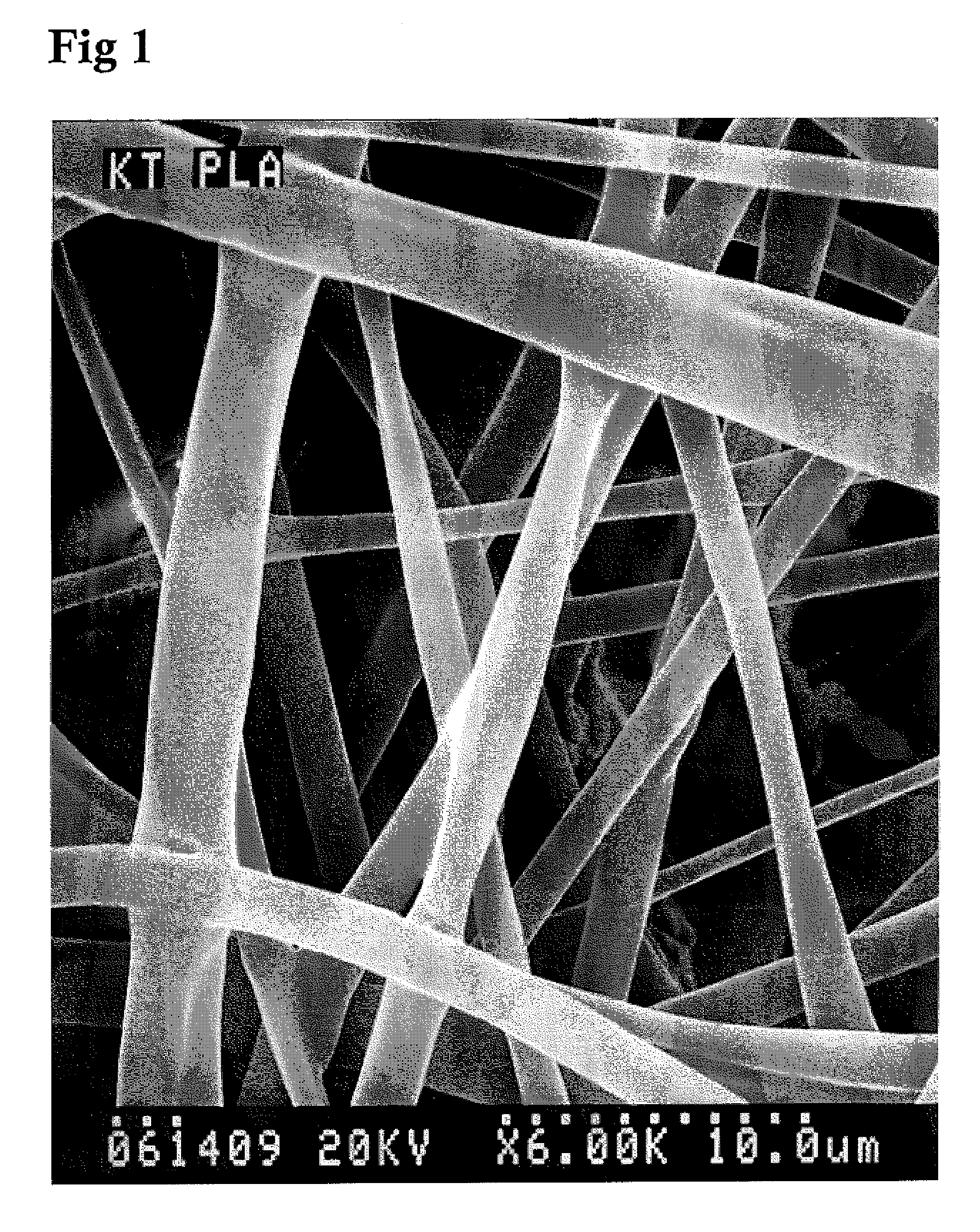 Guided bone regeneration membrane and manufacturing method thereof